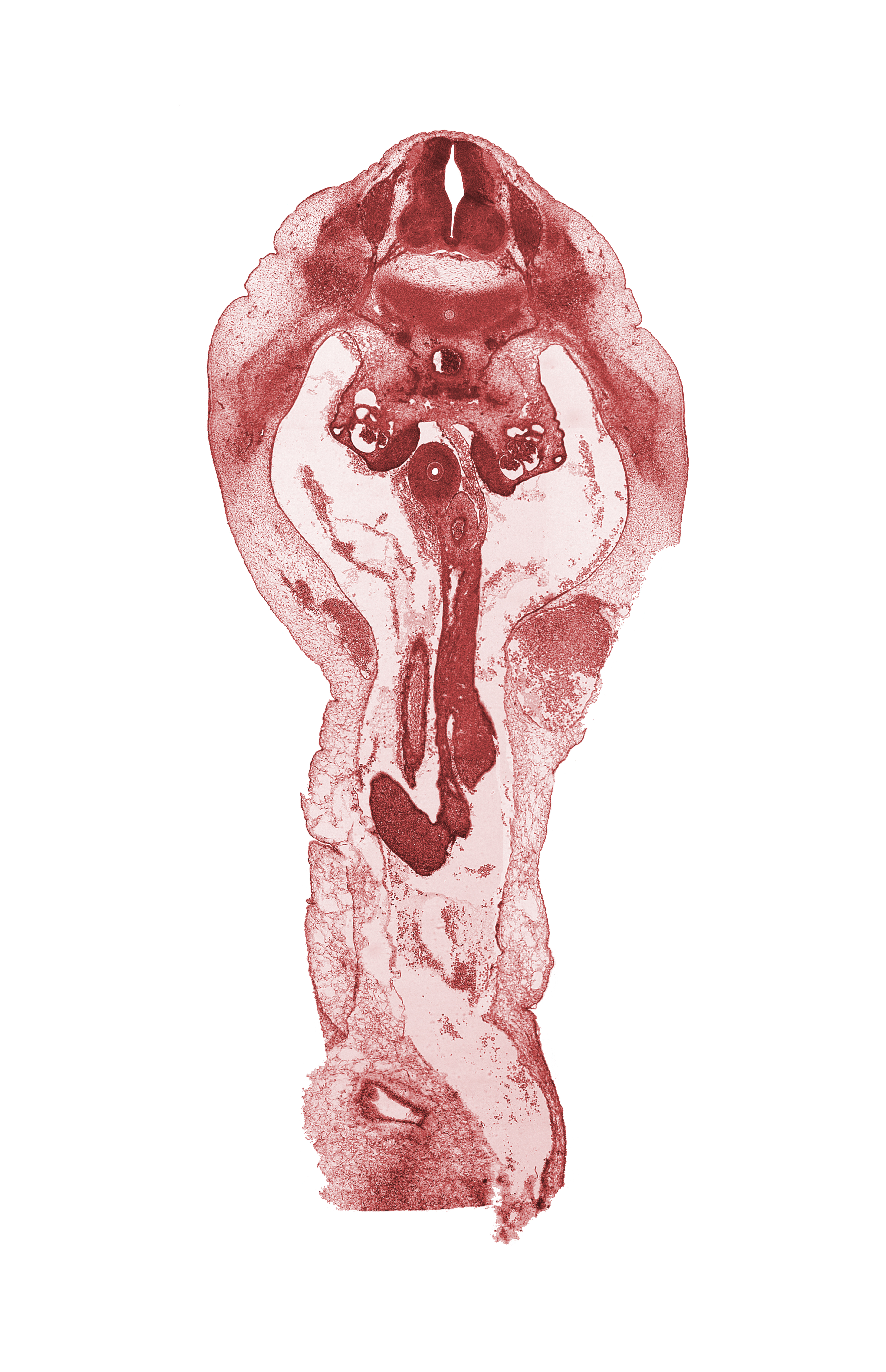 T-12 dorsal root, T-12 spinal ganglion, T-12 ventral root, duodenum, lateral coelomic bay, medial coelomic bay, missing tissue (artifact), notochord, superior mesenteric artery, superior mesenteric vein