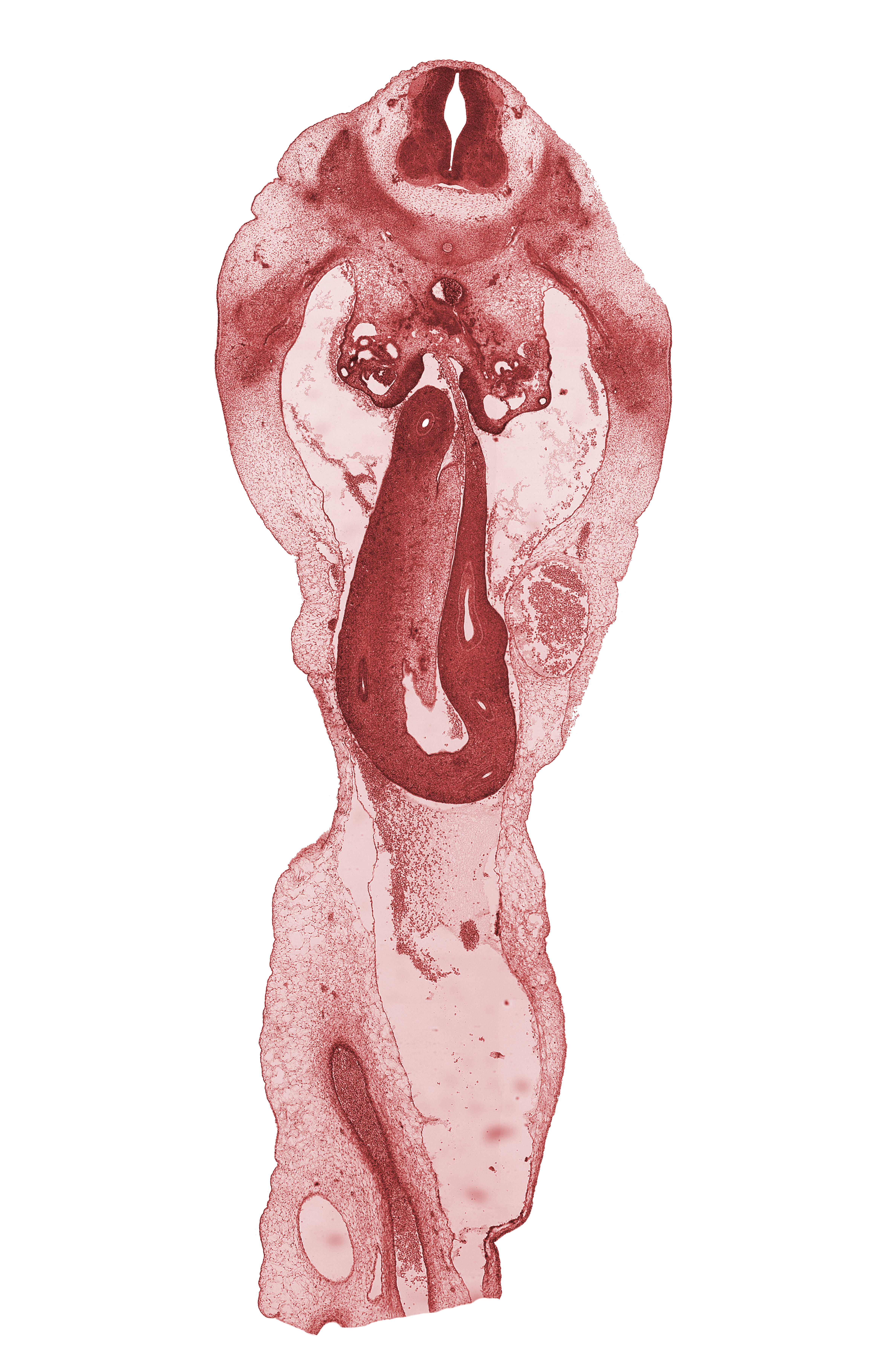 T-12 / L-1 interganglion region, aorta, cecum, distal limb of herniated midgut, duodenum, gonadal ridge, mesonephric duct, midgut mesentery, peritoneal cavity, umbilical coelom, umbilical cord, umbilical vein