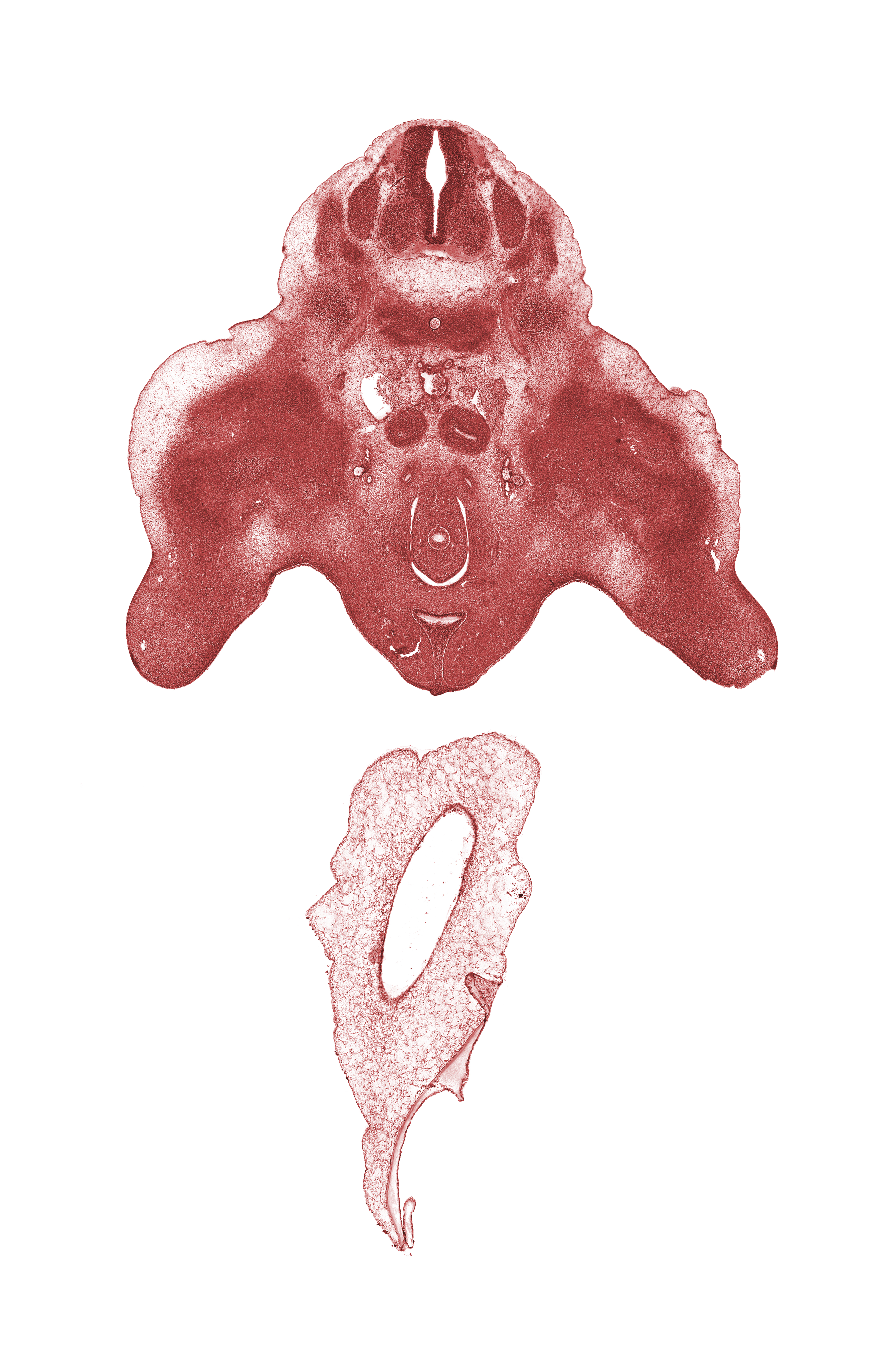 L-3 spinal ganglion, L-4 spinal nerve, branches of internal iliac artery, junction of hindgut and rectum, labioscrotal swelling, leg, major calyx, median sacral artery, metanephric duct (ureter), metanephrogenic blastema, postcardinal vein, skeletal blastema of femur, thigh, urethra (pelvic part of definitive urogenital sinus), urethral fold, urethral groove