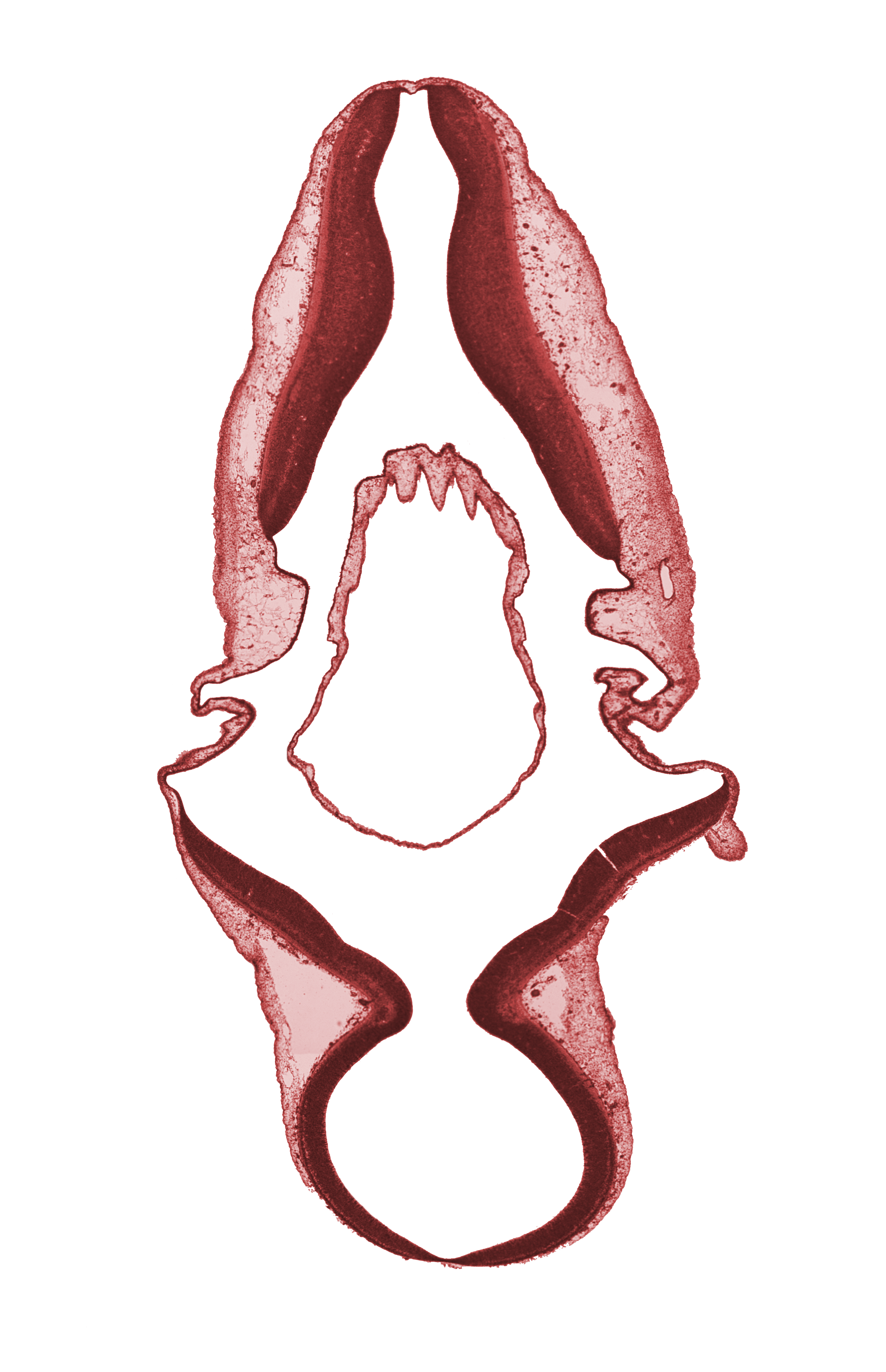 isthmus, mesencephalon (M2), metencephalon, rhombencoel (fourth ventricle), roof plate, roof plate of myelencephalon, root of accessory nerve (CN XI), sulcus limitans