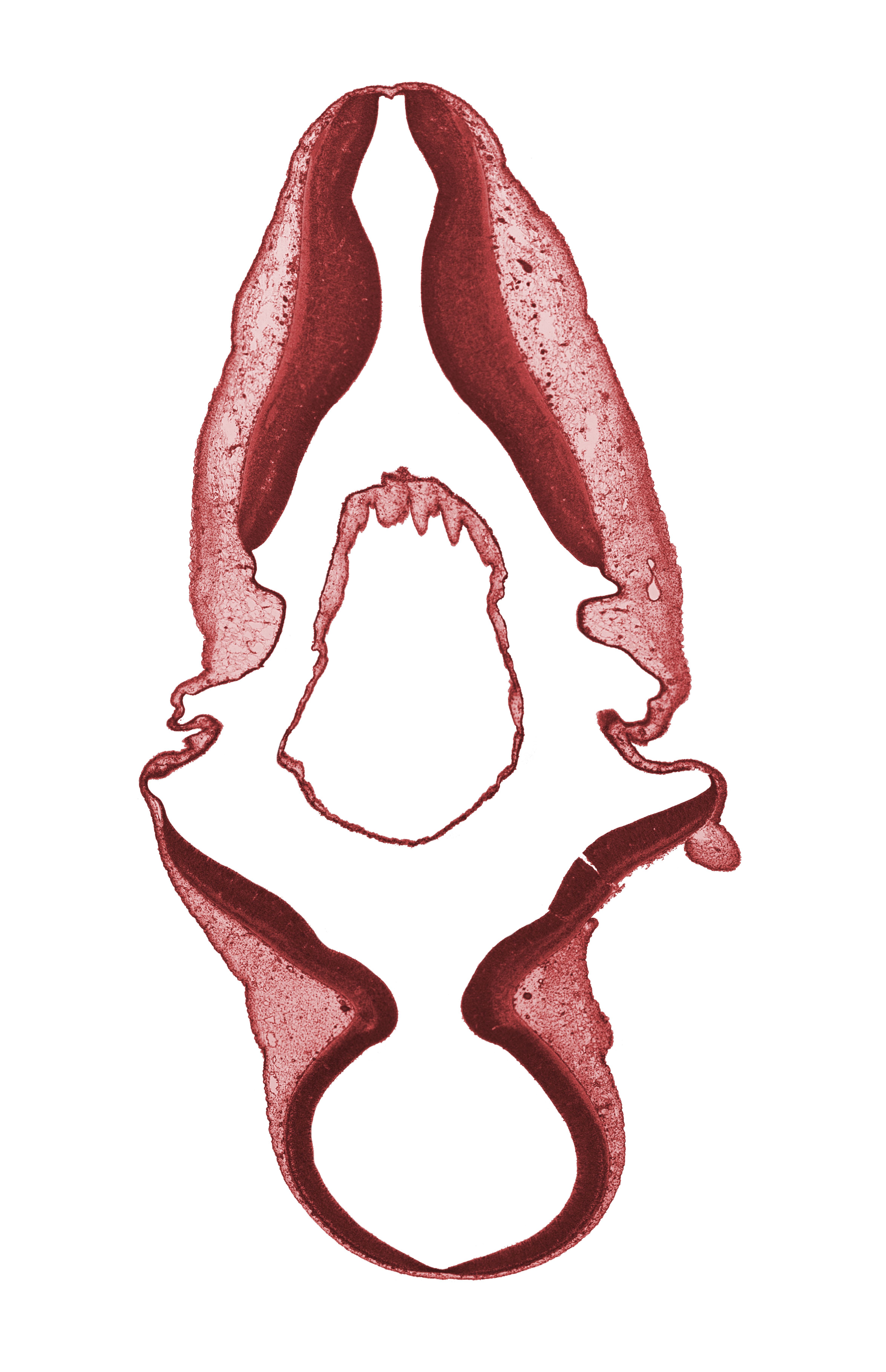 basal plate, edge of root of accessory nerve (CN XI), exterior of embryo, head mesenchyme, myelencephalon, root of trochlear nerve (CN IV)