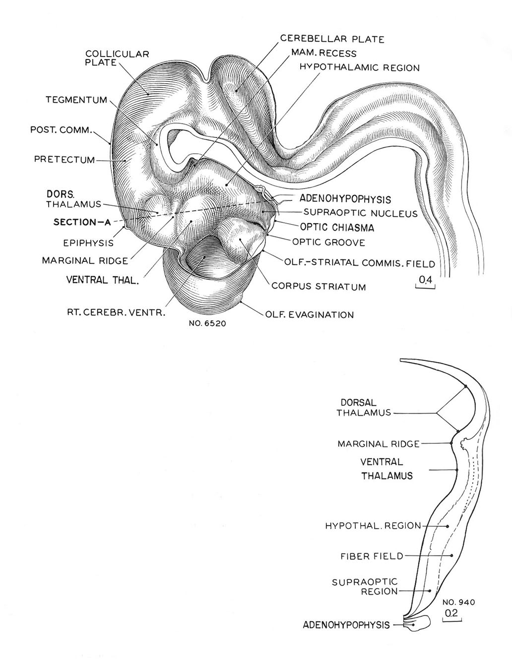 Reconstruction of the right half of the brain