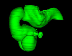 Y-Axis Rotation of the Brain