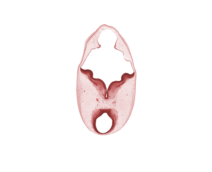 alar plate of metencephalon (cerebellum), artifact separation(s), basal plate, cerebral peduncle, diverticulum of rhombencoel (fourth ventricle), floor plate, osteogenic layer, region of mesencephalic (cephalic) flexure, roof plate, root of oculomotor nerve (CN III), sulcus limitans, surface ectoderm, tectum, tegmentum