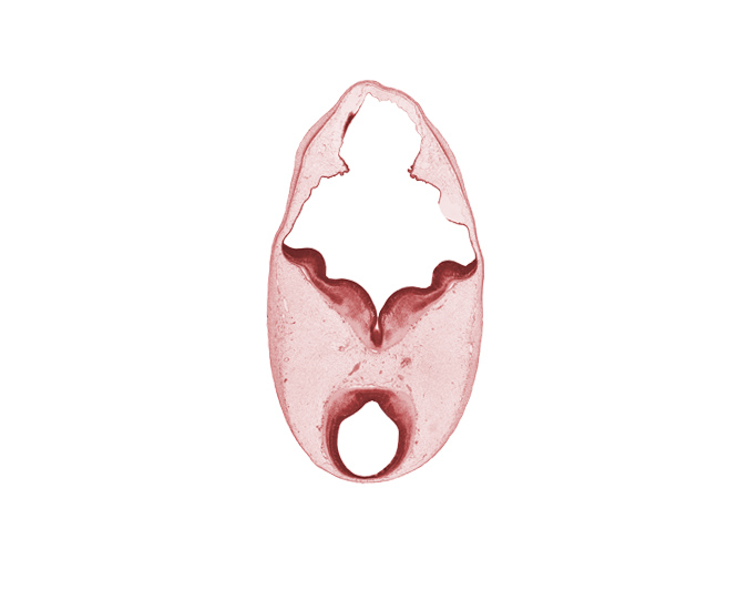 artifact separation(s), cerebral aqueduct (mesencoel), diverticulum of rhombencoel (fourth ventricle), edge of alar plate of myelencephalon, mesencephalon, oculomotor nerve (CN III), rhombencoel (fourth ventricle), trochlear nerve (CN IV)