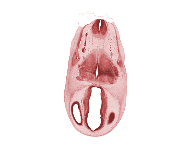 basilar artery, dorsal thalamus, edge of cerebral vesicle(s), endolymphatic sac, epithalamus, hypothalamus, lateral ventricle, osteogenic layer, pyramidal tract region, rhombencoel (fourth ventricle), root of accessory nerve (CN XI), subarachnoid space, third ventricle, transverse fascicle, vagus nerve (CN X), ventral thalamus