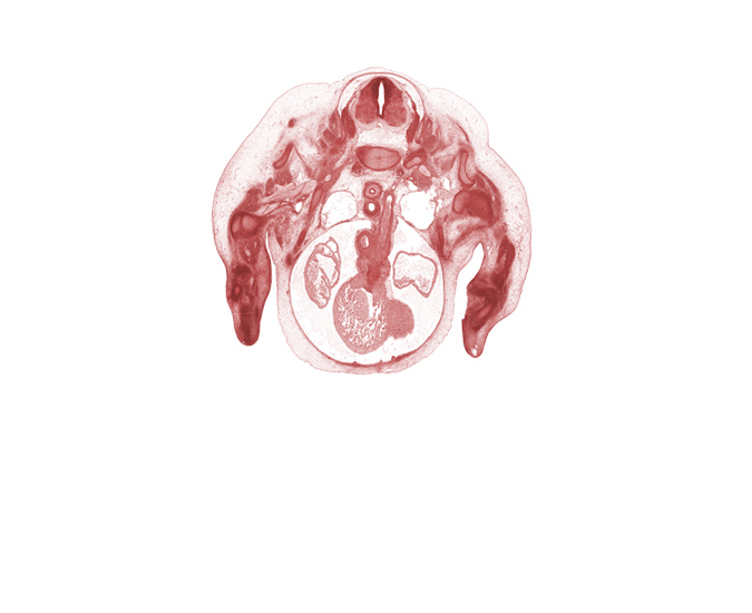 C-7 ventral primary ramus, C-8 spinal ganglion, aorta, aorticopulmonary septum region, ascending aorta, ductus arteriosus, edge of left ventricle, esophagus condensation, inferior cervical sympathetic ganglion, interventricular sulcus, left atrium, left vagus nerve (CN X), neural arch, osteogenic layer, pericardial cavity, precardinal vein, pulmonary trunk, rib 1, right atrium, right ventricle, subarachnoid space, tracheal condensation