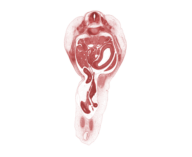 T-11 spinal ganglion, allantois, aorta, communicating ramus, gonadal ridge, inferior vena cava, left lobe of liver, lumen of body of stomach, lumen of pyloric antrum of stomach, midgut mesentery, proximal limb of herniated midgut, right lobe of liver, spleen, superior mesenteric artery, superior mesenteric vein, sympathetic trunk, umbilical coelom, ventral pancreas