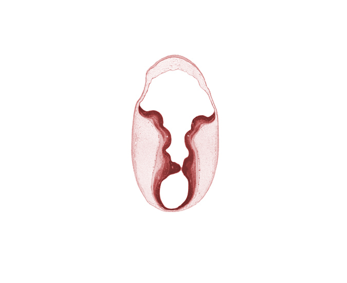 head mesenchyme, mesencephalon (M2), metencephalon, osteogenic layer, surface ectoderm, trochlear nerve (CN IV)