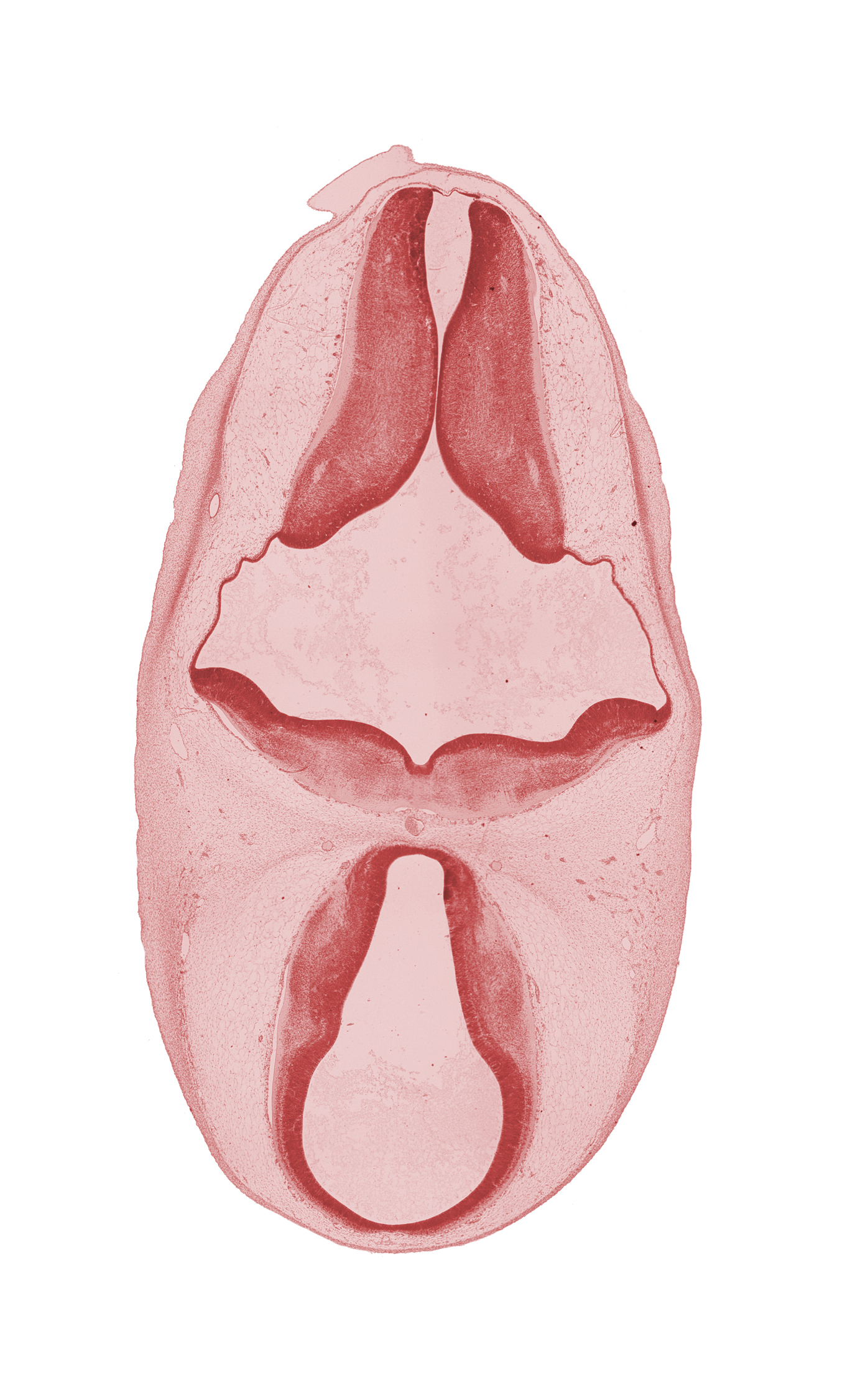 basilar artery, diencephalon, metencephalon, rhombencoel (fourth ventricle), sulcus terminalis, third ventricle
