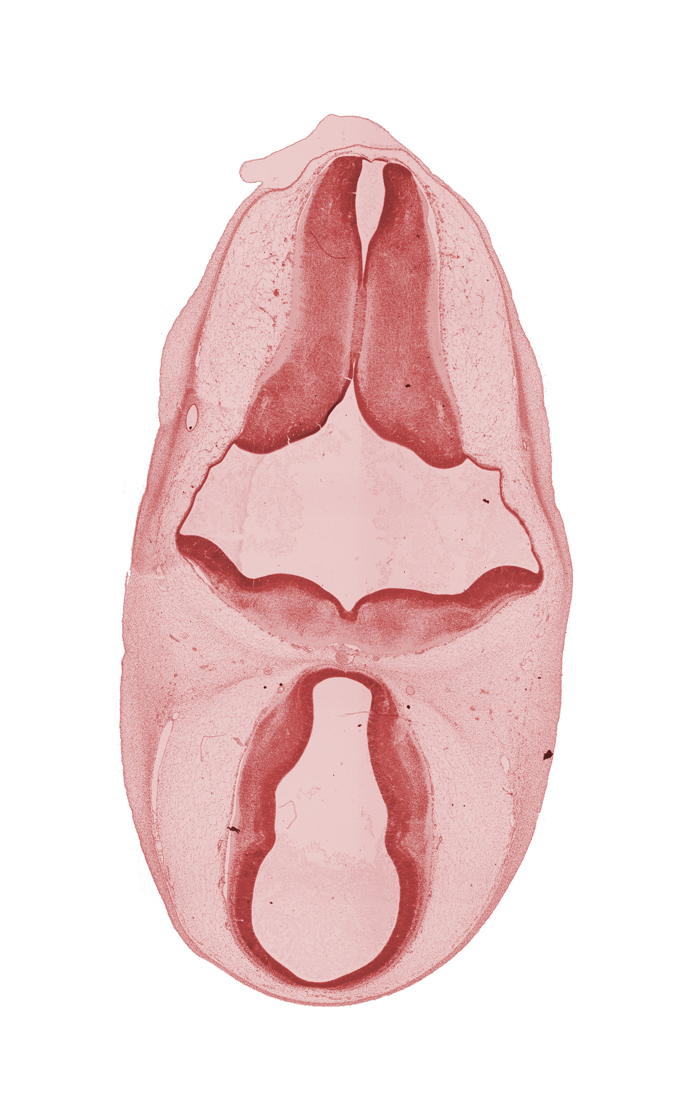 dorsal sulcus, dorsal thalamus, endolymphatic duct, epithalamus, hypothalamus, marginal ridge, osteogenic layer, rhombencoel (fourth ventricle), subarachnoid space, third ventricle, ventral thalamus
