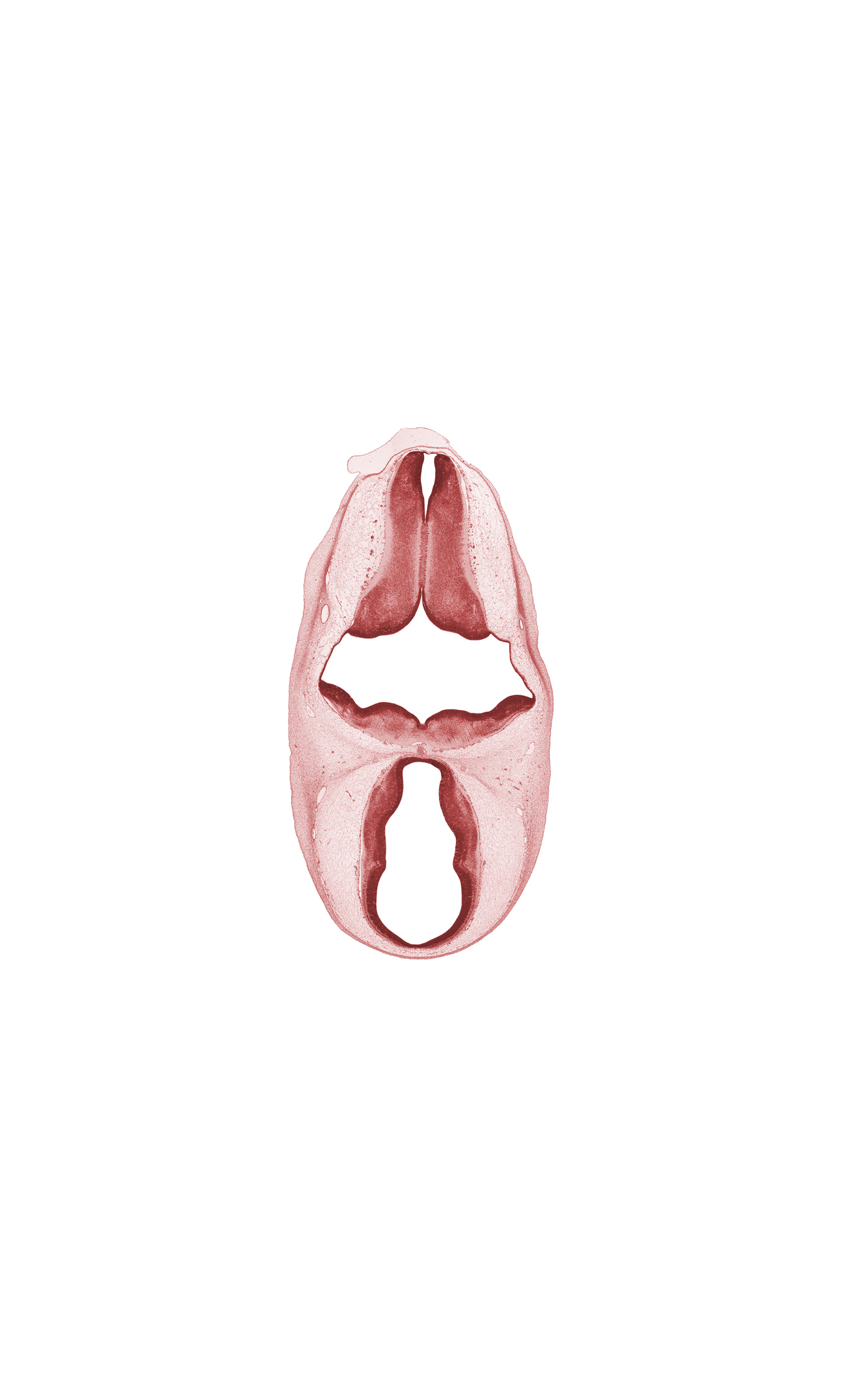 alar plate(s), basal plate, decussation, marginal ridge, oculomotor nerve (CN III), rhombencoel (fourth ventricle), roof plate, subarachnoid space, sulcus limitans, trochlear nerve (CN IV)