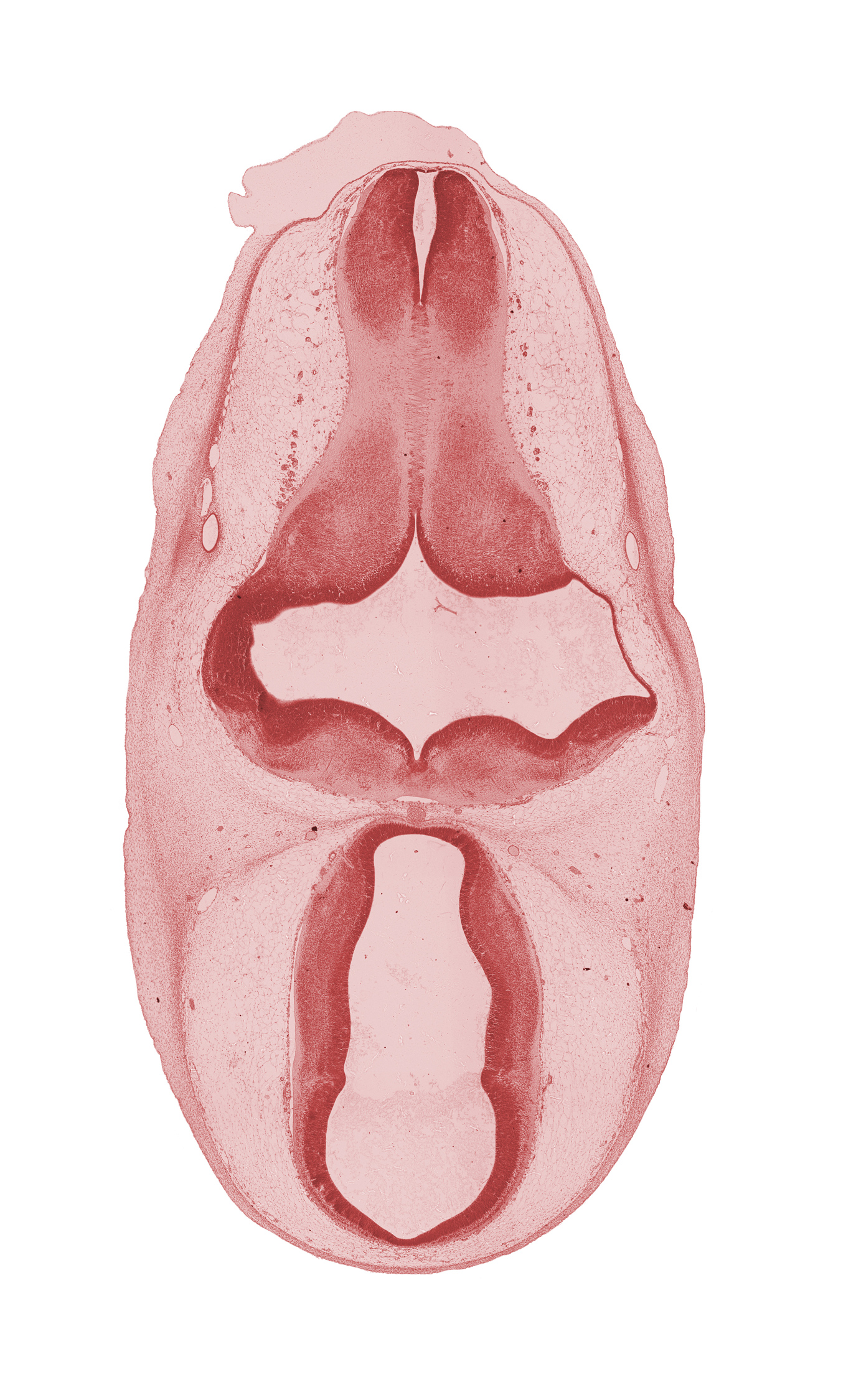 dorsal thalamus, head mesenchyme, hypothalamus, junction of metencephalon and myelencephalon, marginal ridge, median sulcus, myelencephalon (medulla oblongata), oculomotor nerve (CN III), osteogenic layer, pyramidal tract region, roof plate, surface ectoderm, trochlear nerve (CN IV), ventral thalamus