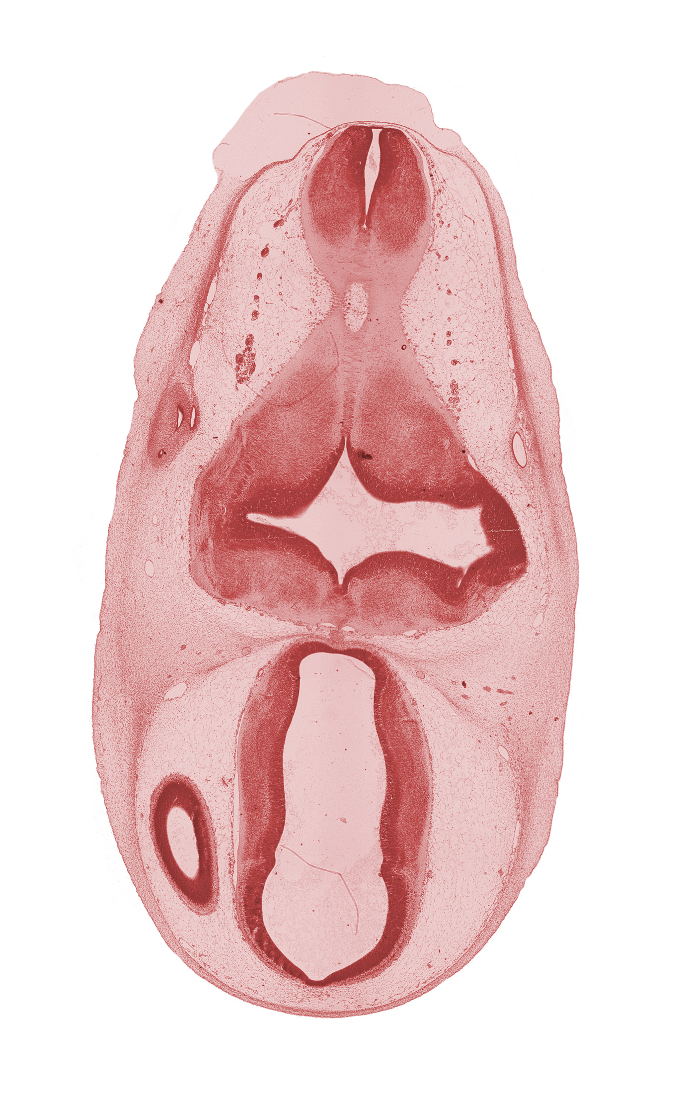 dorsal sulcus, dorsal thalamus, edge of lateral ventricle, endolymphatic sac, epithalamus, hypothalamus, intermediate zone, marginal ridge, marginal zone, otic capsule, pyramidal tract region, rhombencoel (fourth ventricle), third ventricle, ventral thalamus, ventricular zone