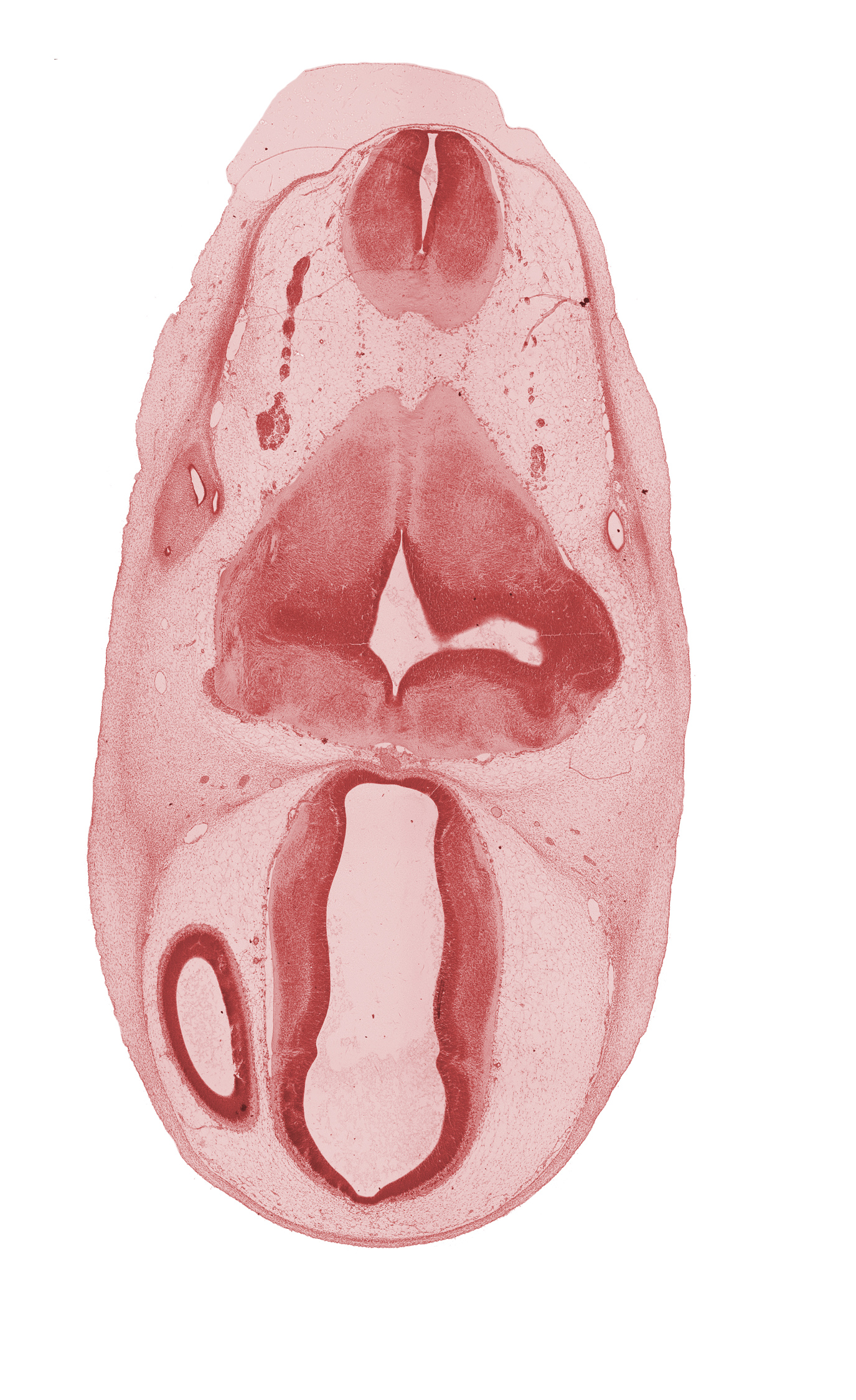 dorsal thalamus, endolymphatic sac, hypothalamus, intermediate zone, marginal ridge, marginal zone, myelencephalon, osteogenic layer, region of cervical flexure, subarachnoid space, vagus nerve (CN X), vascular plexus, ventral thalamus, ventricular zone