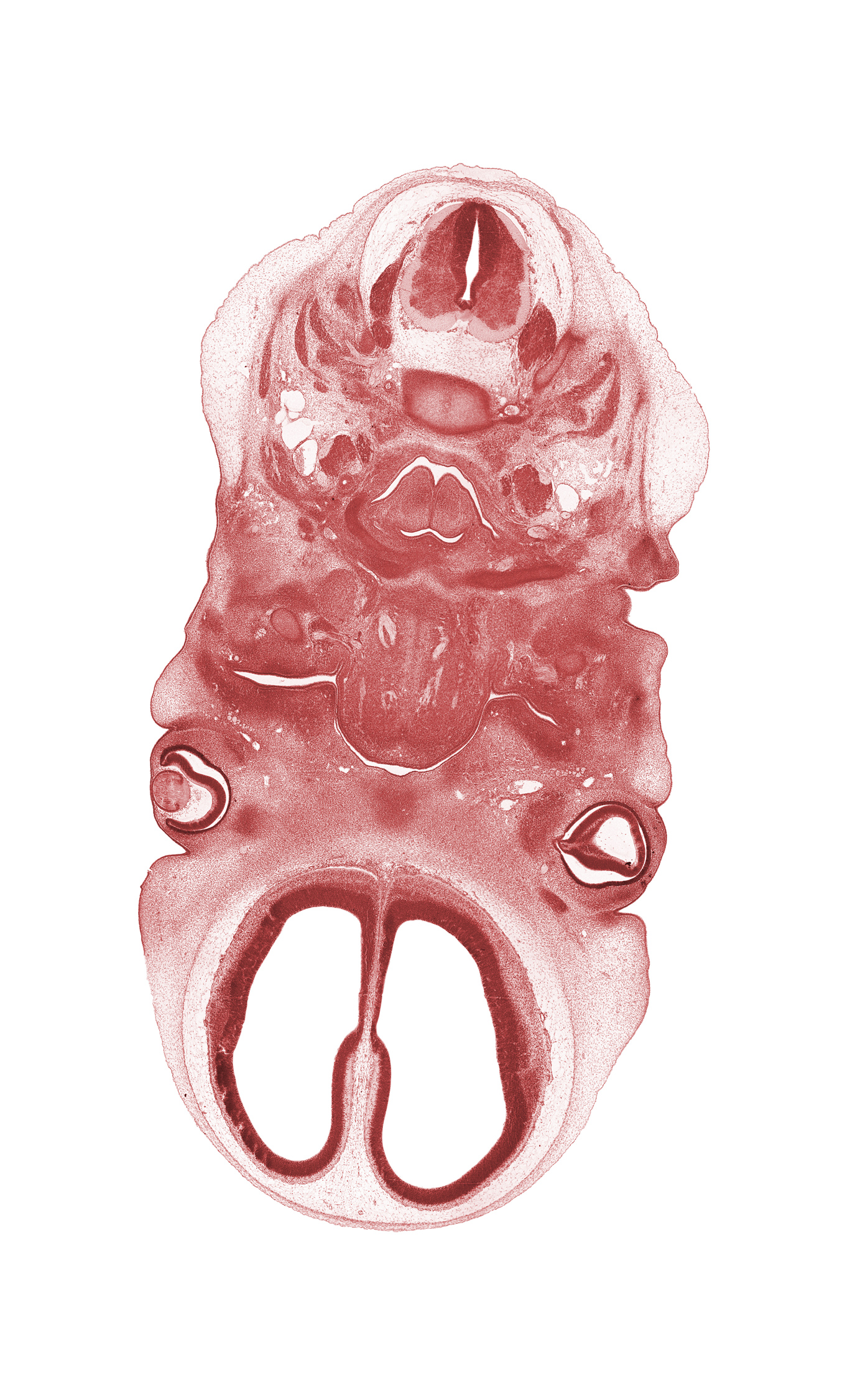 C-2 / C-3 intervertebral disc, C-3 spinal ganglion, C-3 spinal nerve, T-shaped larynx lumen, U-shaped laryngeal pharynx, blastema of extra-ocular muscle(s), glossopharyngeal nerve (CN IX), intraretinal space (optic vesicle cavity), neural layer of retina, palatine shelf, pigmented layer of retina, precardinal vein, spinal accessory nerve (CN XI), thyroglossal duct remnant, vertebral artery, vitreous cavity