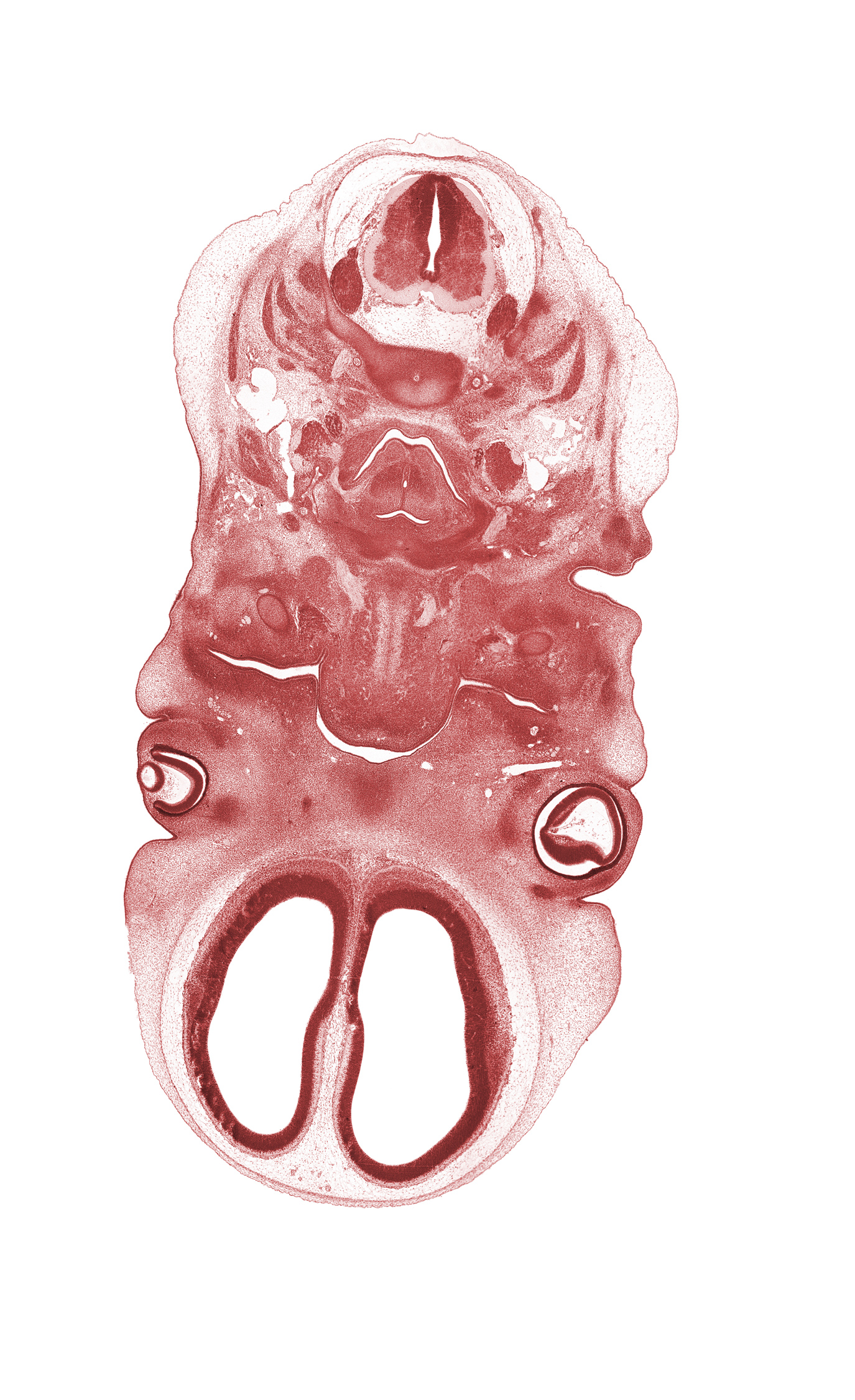 C-2 / C-3 intervertebral disc, C-3 spinal ganglion, C-3 spinal nerve, arytenoid swelling, blastemata of extra-ocular muscle(s), central canal, cornea, ethmoid condensation, extrinsic tongue muscle(s), falx cerebri region, glossopharyngeal nerve (CN IX), hypoglossal nerve (CN XII), lateral ventricle, maxillary prominence of pharyngeal arch 1, notochord, spinal accessory nerve (CN XI), sternocleidomastoid muscle, superior cervical sympathetic ganglion, trapezius muscle