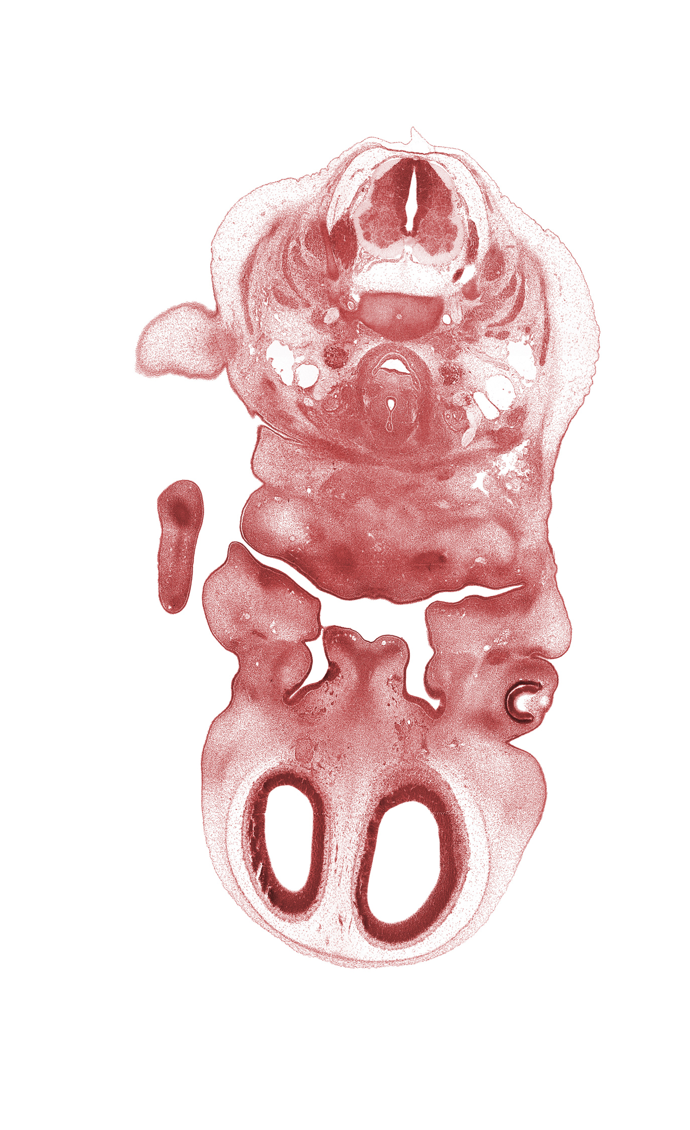 C-3 / C-4 intervertebral disc, C-4 spinal ganglion, C-4 spinal nerve, angle of mouth, centrum of C-4 vertebra, cephalic edge of C-5 spinal ganglion, dorsal fasciculus, edge of shoulder, frontal prominence, head mesenchyme, inferior ganglion of vagus nerve (CN X), jugular lymph sac, larynx condensation, mandibular nerve (CN V₃), maxillary prominence of pharyngeal arch 1, middle cervical sympathetic ganglion, nasal septal cartilage condensation, olfactory bulb, oral cavity, osteogenic layer, precardinal vein, remnant of oronasal membrane, sternocleidomastoid muscle, surface ectoderm, ventral horn of grey matter