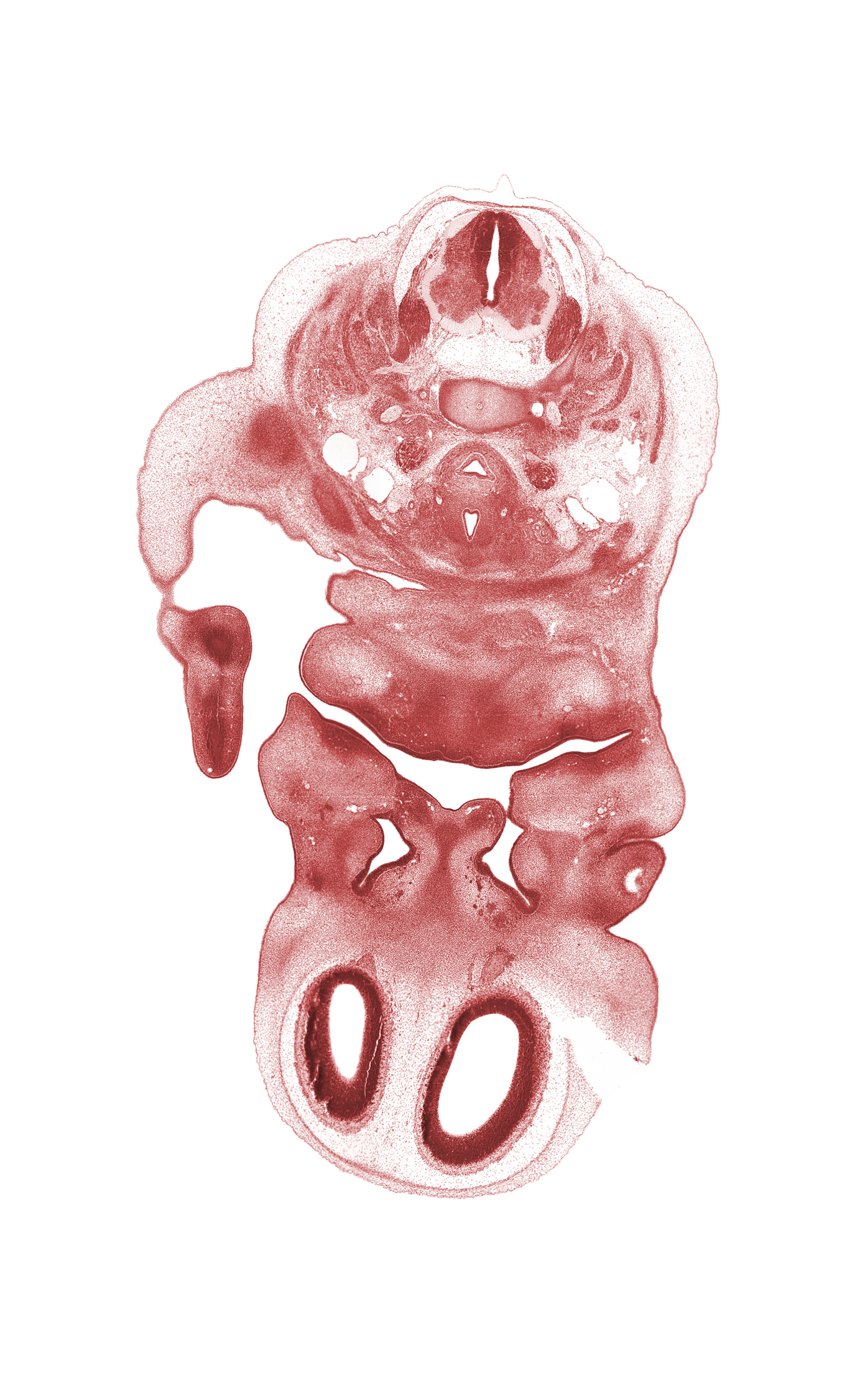 C-4 ventral primary ramus, C-5 spinal ganglion, anterior scalene muscle, artifact fracture(s), artifact separation(s), carpal condensation, centrum of C-4 vertebra, clavicle, common carotid artery, intermediate zone, lower eyelid, marginal zone, maxillary prominence of pharyngeal arch 1, middle scalene muscle, nasal fin, neural arch, olfactory filia (CN I), oral cavity, pharyngeal arch 1 cartilage (Meckel), platysma muscle, recurrent laryngeal nerve, superior parathyroid gland, upper eyelid, vertebral artery, vomeronasal nerve, vomeronasal organ