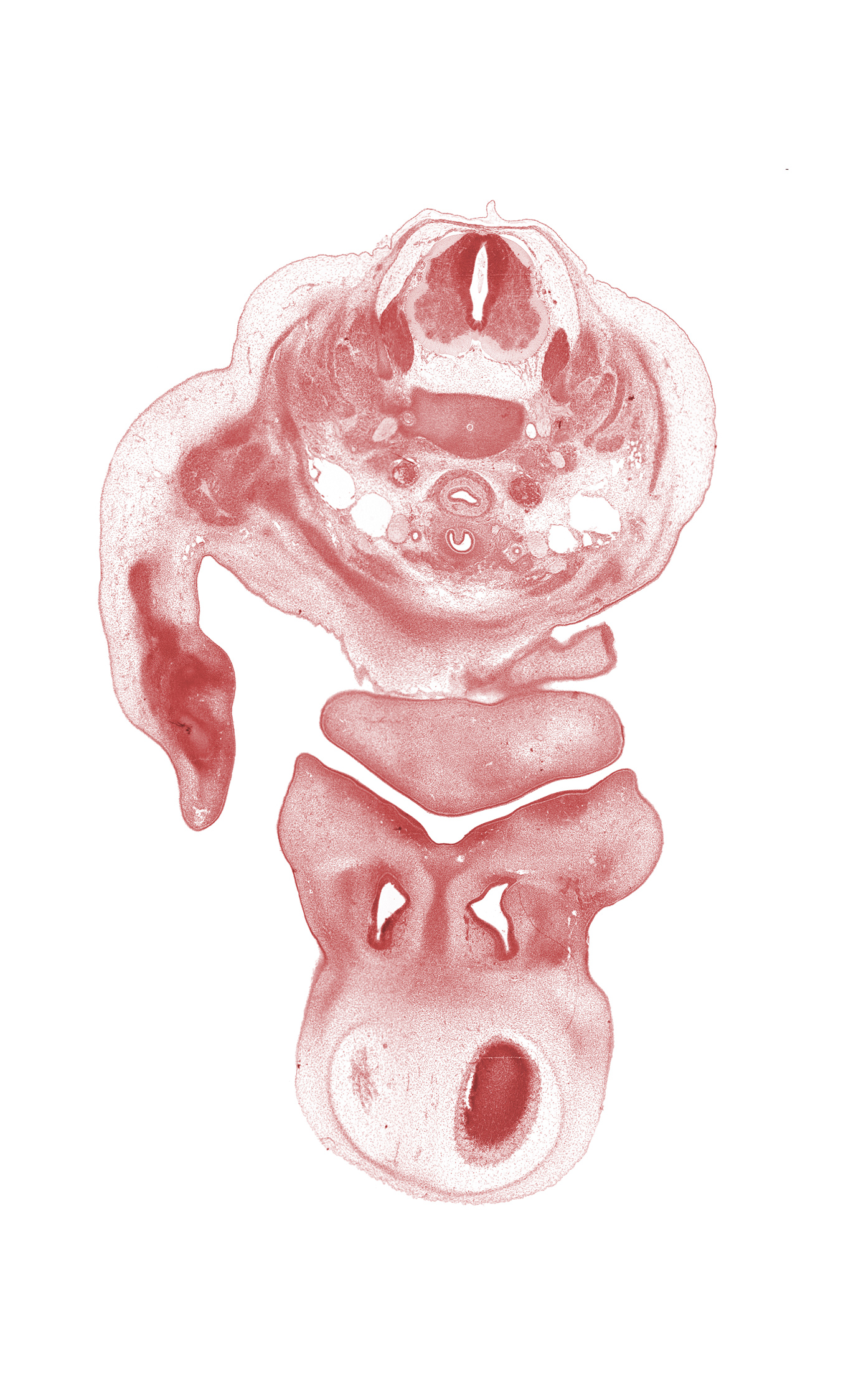 C-4 / C-5 intervertebral disc, C-4 ventral primary ramus, C-5 spinal ganglion, C-5 spinal nerve, anterior scalene muscle, artifact separation(s), chin, common carotid artery, frontal part of cerebral vesicle (telencephalon), isthmus of thyroid gland, jugular lymph sac, marginal vein, maxillary prominence of pharyngeal arch 1, middle scalene muscle, nasal capsule cartilage condensation, nasolacrimal duct, oral fissure, osteogenic layer, precardinal vein, primary palate, sternocleidomastoid muscle, subarachnoid space, thymus gland