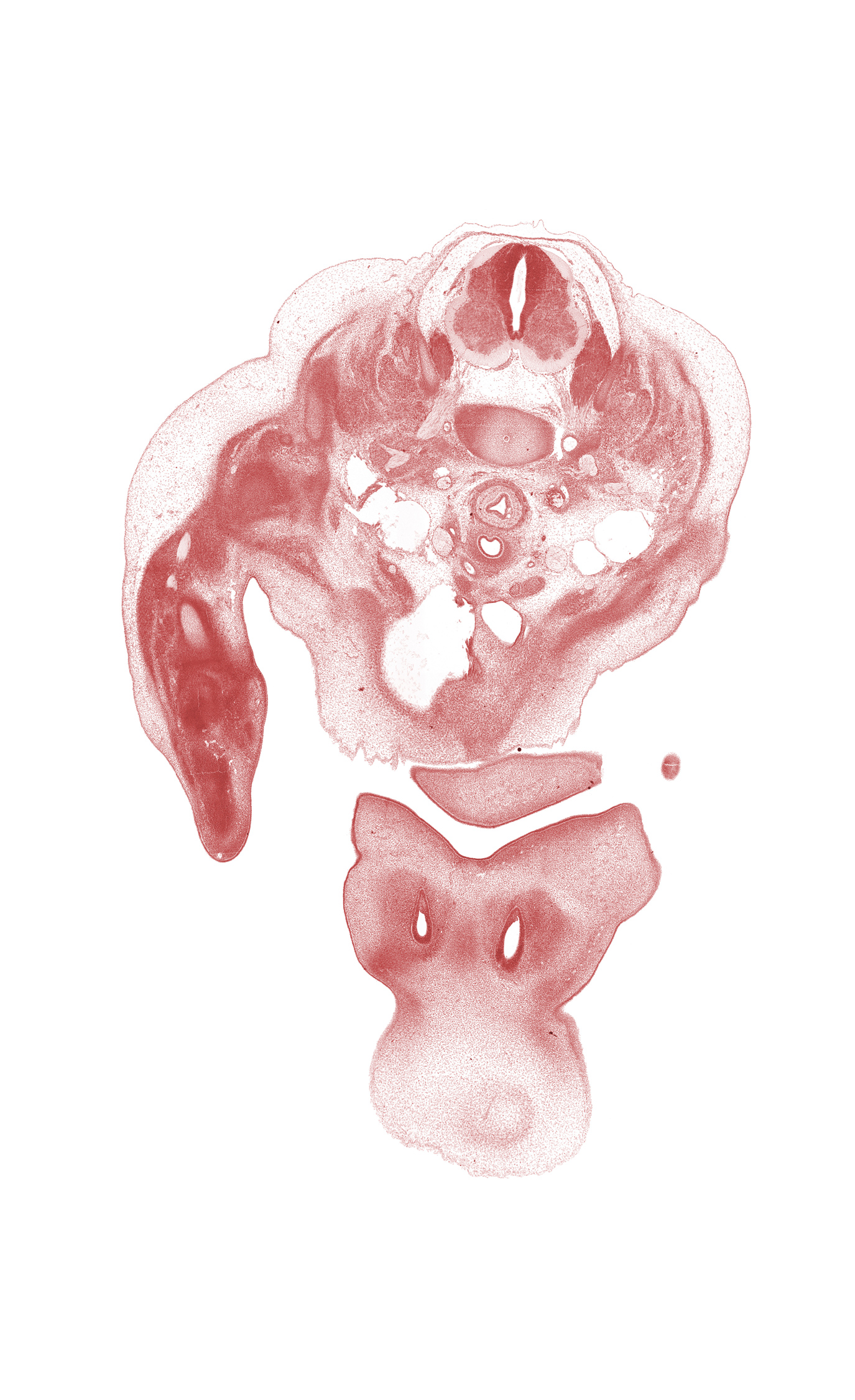 C-5 / C-6 intervertebral disc, C-5 ventral primary ramus, C-6 spinal ganglion, C-6 spinal nerve, brachiocephalic artery, cephalic edge of upper limb, chin, common carotid artery, deltoid muscle, dorsal root(s), edge of pericardial cavity, esophagus endoderm, frontal prominence, interorbital groove, lateral nasal prominence, maxillary prominence of pharyngeal arch 1, nasomaxillary groove, primary palate, subclavian artery, thymus gland, trachea (endoderm), trapezius muscle