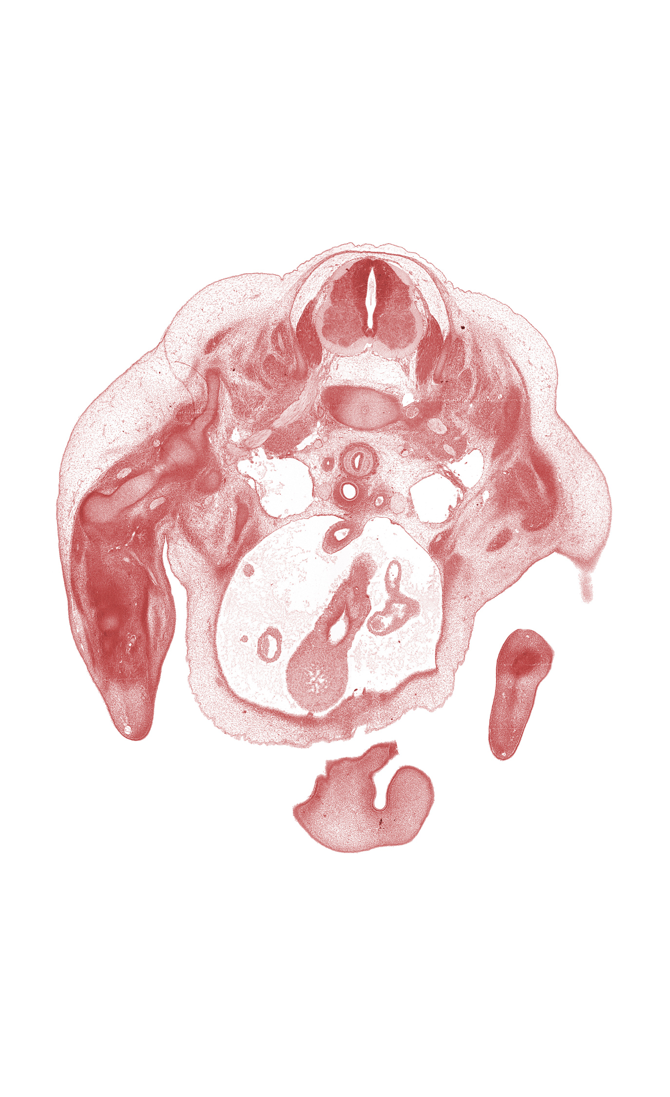 C-5 ventral primary ramus, C-6 ventral primary ramus, C-7 dorsal root, C-7 spinal ganglion, ascending aorta, axillary nerve, blastema of deltoid muscle, central canal, descending aorta, edge of infundibulum of right ventricle, edge of left atrium, edge of nose, hand ray condensation, heart prominence, humerus, junction of precardinal and subclavian veins, naris, osteogenic membrane, precardinal vein, radial nerve, right atrium, scapula, subclavian artery