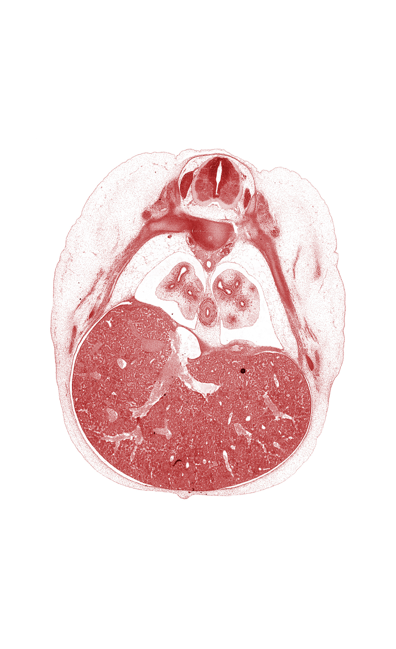 T-7 spinal ganglion, aorta, dorsal meso-esophagus, esophagus, inferior vena cava, left lobe of liver, left vagus nerve (CN X), pleural cavity, pleural recess, rib 7, rib 8, right lobe of liver, ventral horn of grey matter