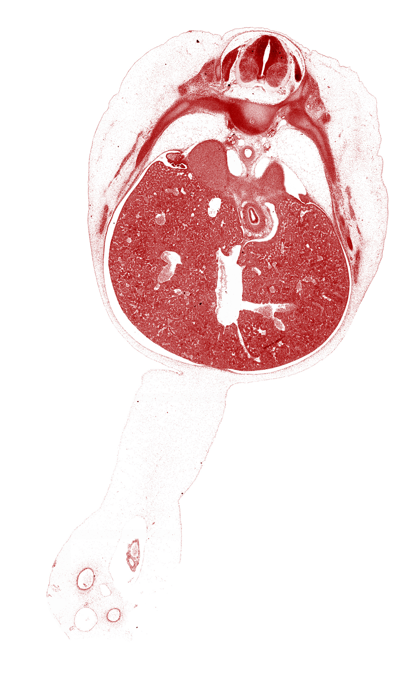 T-8 spinal ganglion, afferent hepatic vein, aorta, cephalic edge of mesonephros, cephalic edge of suprarenal gland, ductus venosus, inferior vena cava, junction of esophagus and stomach, omphalomesenteric artery, peritoneal cavity, rib 10, rib 9, sympathetic trunk, umbilical coelom