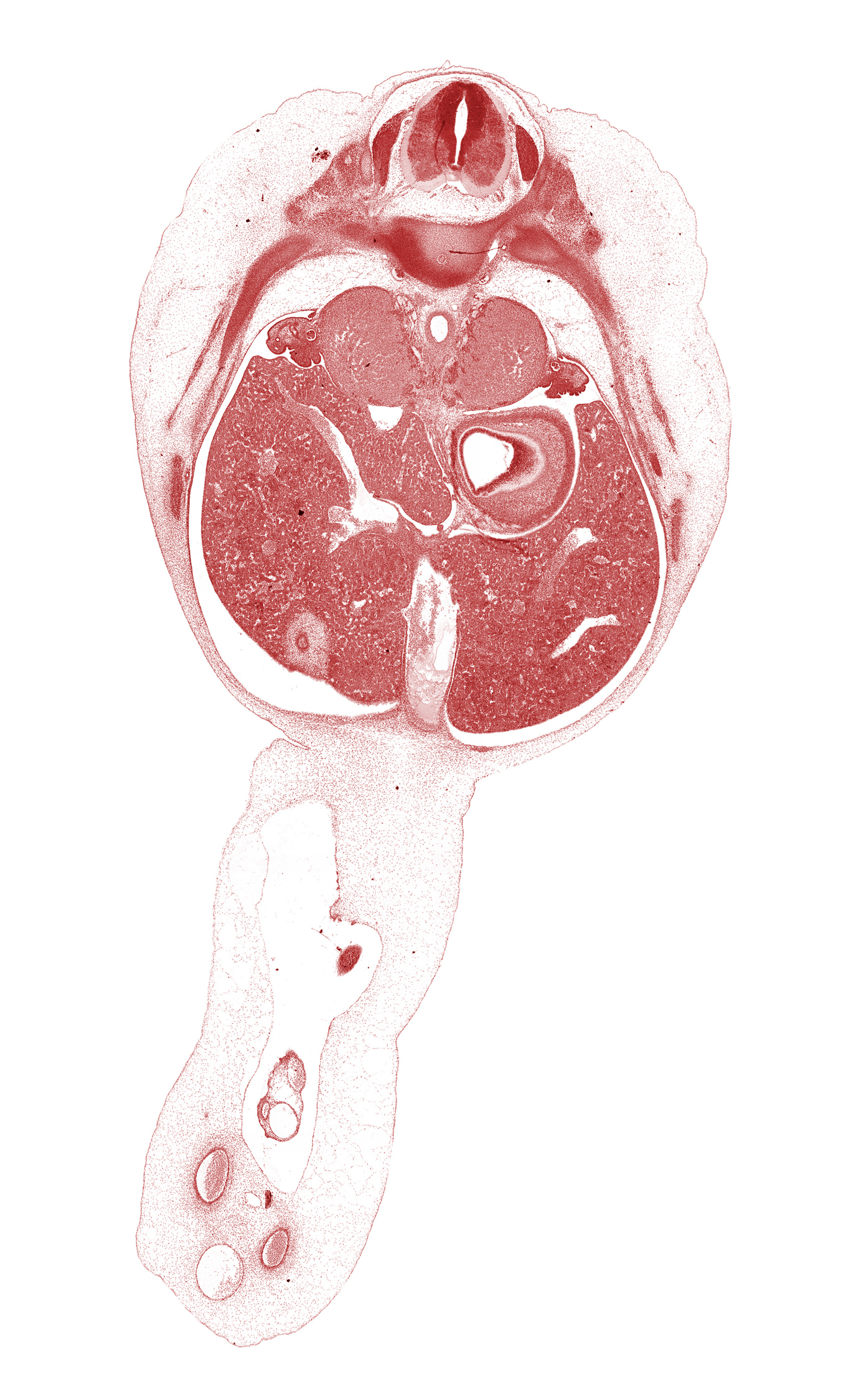 T-9 spinal ganglion, allantois, amnion on surface of umbilical cord, aorta, ductus venosus, edge of herniated midgut, fundus of stomach, gall bladder, head of rib 10, inferior vena cava, junction of ductus venosus and hepatic portal vein, left lobe of liver, left umbilical artery, mesonephric duct, paramesonephric groove, quadrate lobe of liver, rib 11, right umbilical artery, suprarenal gland cortex, surface ectoderm, umbilical vein