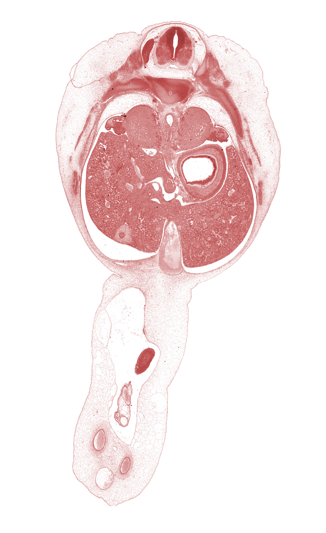 T-10 intercostal nerve, T-9 / T-10 interganglion region, celiac trunk, external abdominal oblique muscle, gall bladder, hepatic portal vein, internal abdominal oblique muscle, junction of ductus venosus and umbilical vein, left lobe of liver, lumen of body of stomach, omphalomesenteric artery, quadrate lobe of liver, rectus abdominis muscle, rib 10, rib 11, right lobe of liver, spleen, subarachnoid space, suprarenal gland medulla, sympathetic trunk, transversus abdominis muscle, umbilical coelom, wall of herniated midgut