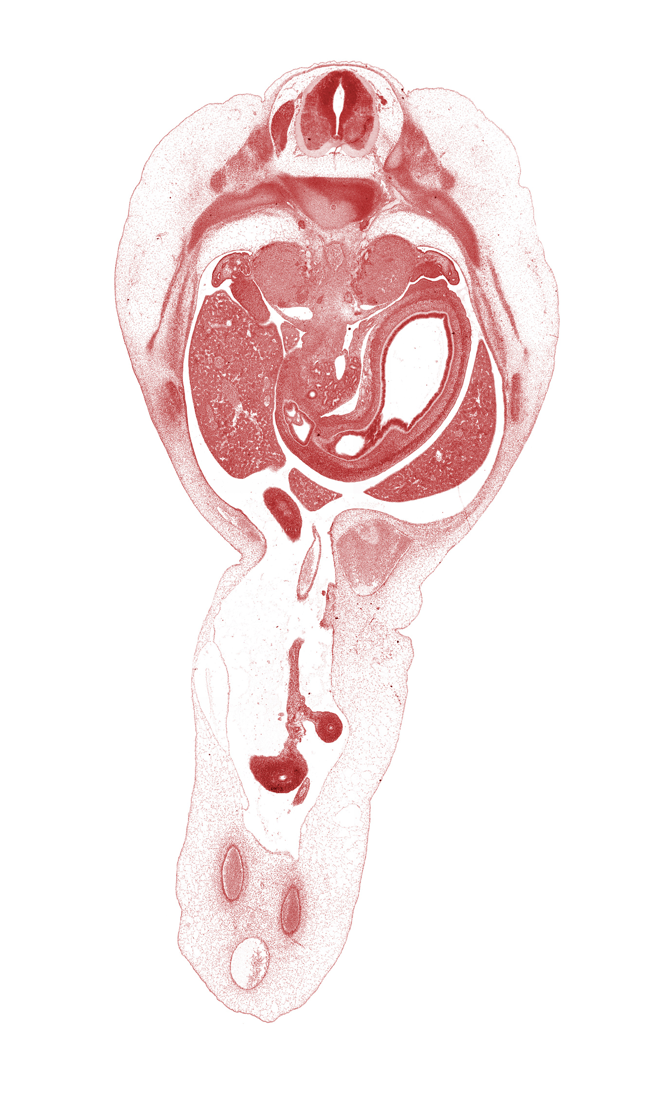 T-10 / T-11 interganglion region, T-11 / T-12 intervertebral disc, T-11 intercostal nerve, dorsal pancreas, duodenum, duodenum bulb, gonadal ridge, hepatic portal vein, left lobe of liver, left umbilical artery, lumen of body of stomach, mesentery of herniated midgut, midpoint of midgut, neural arch, omphalomesenteric artery, pyloric antrum of stomach, pylorus of stomach, right lobe of liver, right umbilical artery, superior mesenteric artery, suprarenal gland cortex, sympathetic trunk, umbilical vein