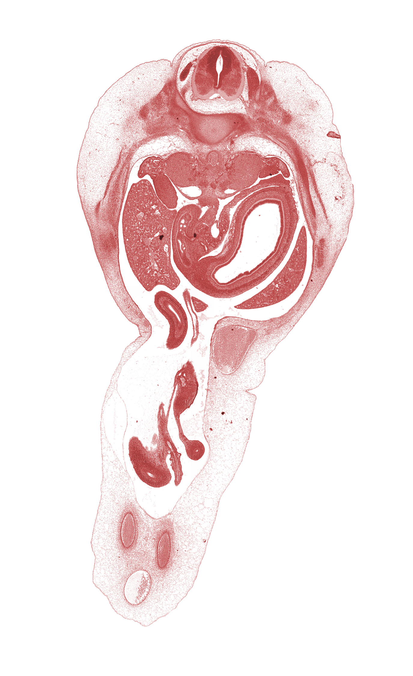 T-11 intercostal nerve, T-11 spinal ganglion, bile duct, blastemata of deep back muscles, caudal edge of quadrate lobe of liver, distal limb of herniated midgut, dorsal mesogastrium, duodenum (second part), gonadal ridge, hepatic portal vein, inferior vena cava, junction of omphaloenteric and superior mesenteric arteries, left lobe of liver, lesser sac (omental bursa), proximal limb of herniated midgut, pyloric antrum of stomach, right lobe of liver, superior mesenteric artery, umbilical vein