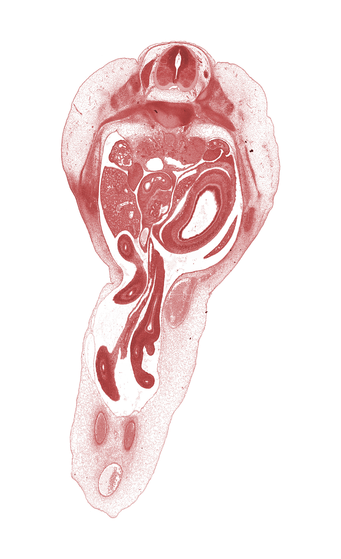 allantois, caudal edge of left lobe of liver, cephalic edge of T-12 spinal ganglion, distal limb of herniated midgut, duodenum (second part), left umbilical artery, lesser sac (omental bursa), mesonephros, midgut mesentery, osteogenic layer, proximal limb of herniated midgut, proximal limb of herniated midgut (jejunum), rib 12, right umbilical artery, spleen, splenic vein, superior mesenteric artery, superior mesenteric vein, umbilical vein, ventral pancreas