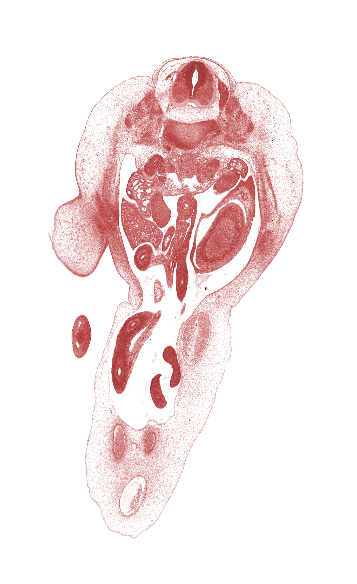 T-12 / L-1 intervertebral disc, T-12 spinal ganglion, T-12 spinal nerve, amnion on surface of umbilical cord, aorta, central canal, condensation in wall of proximal limb of herniated midgut, duodenum (third part), edge of distal limb of herniated midgut, edge of right umbilical artery, greater sac, junction of hindgut and midgut, marginal vein in foot, mesonephric duct, mesonephros, mucoid connective tissue, ovary, subarachnoid space, subcostal nerve (T-12), thigh, umbilical coelom, umbilical vein