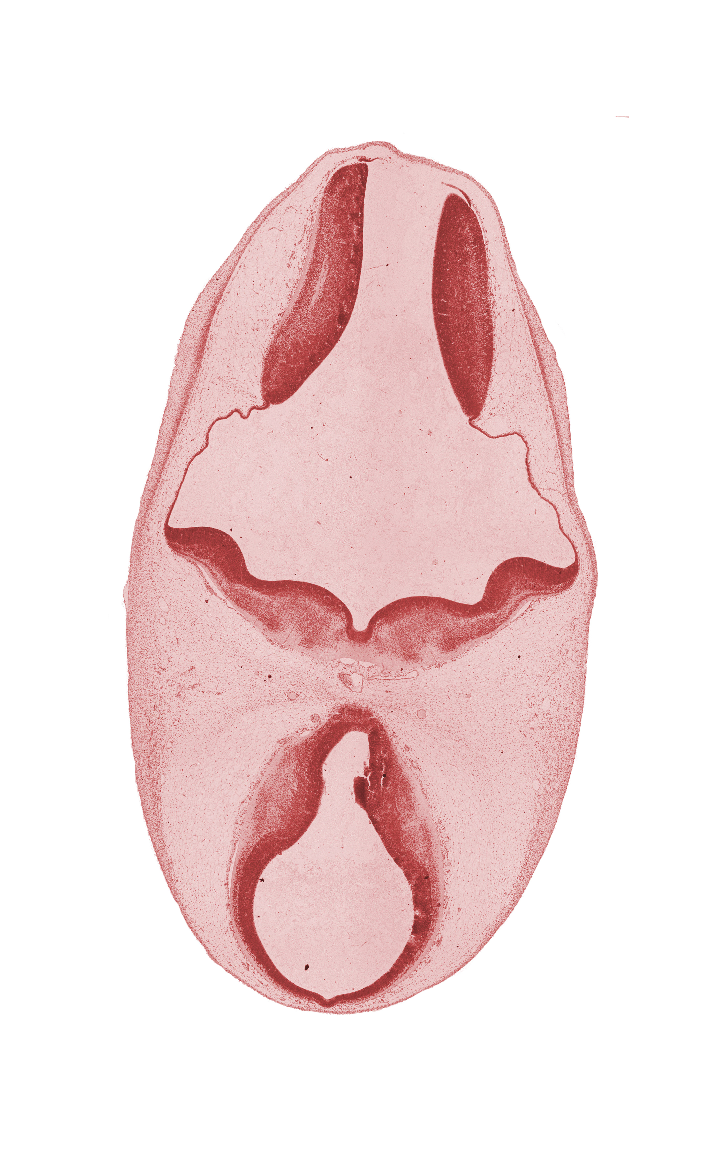 alar plate of metencephalon, alar plate of myelencephalon, artifact separation(s), basilar artery, diencephalon, head mesenchyme, oculomotor nerve (CN III), osteogenic layer, pineal bud, roof plate, subarachnoid space, third ventricle, trochlear nerve (CN IV)