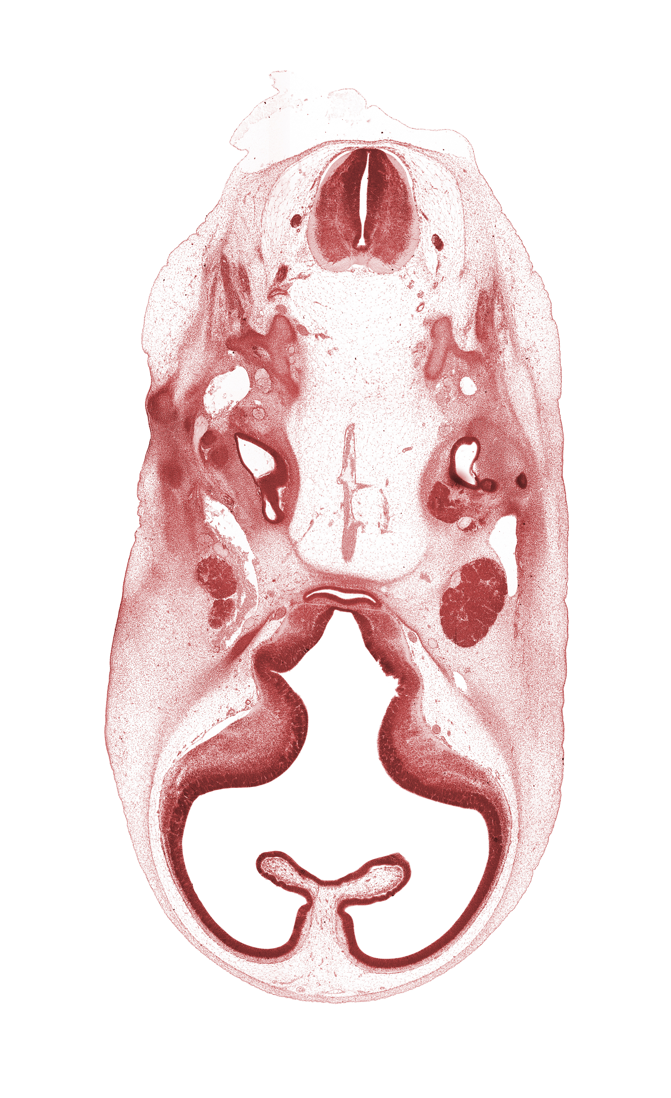 abducens nerve (CN VI), accessory nerve (CN XI), adenohypophysis, basilar artery, central canal, choroid fissure, facial nerve (CN VII), glossopharyngeal nerve (CN IX), hypoglossal nerve (CN XII), lateral semicircular duct, optic groove, primary head vein, spinal accessory nerve (CN XI), stem of anterior dural venous plexus, stem of middle dural venous plexus, striatal part of cerebral vesicle (telencephalon), subarachnoid space, suprastriatal part of cerebral vesicle (telencephalon), vagus nerve (CN X), ventricular eminence(s), vertebral artery, vestibulocochlear ganglion (CN VIII)