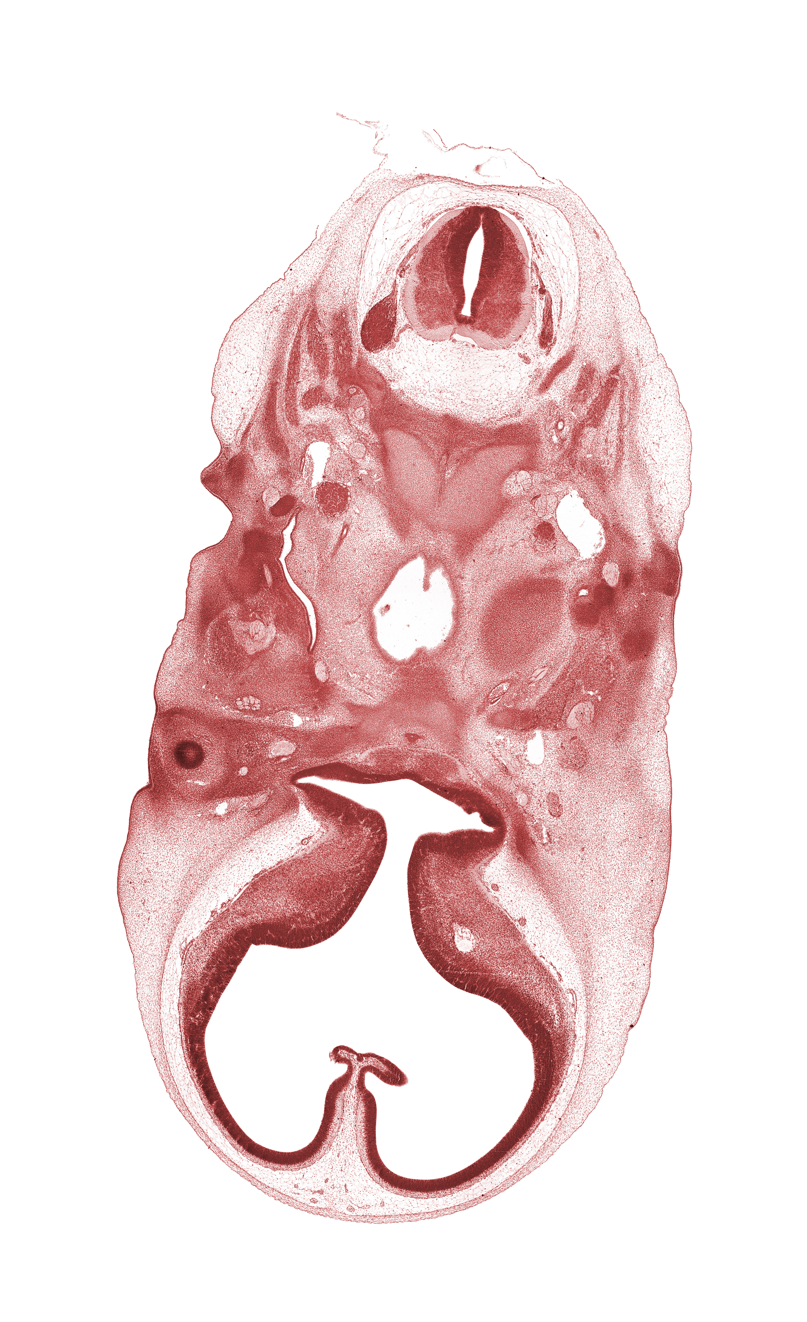 C-1 dorsal root, C-1 spinal nerve, alisphenoid, basi-occipital (basal plate), basisphenoid, caudal edge of adenohypophysis, cephalic edge of C-2 spinal ganglion, cephalic edge of pharynx, hypoglossal canal, mandibular nerve (CN V₃), maxillary nerve (CN V₂), notochord, ophthalmic nerve (CN V₁), orbitosphenoid, pharyngotympanic tube, precardinal vein, spinal accessory nerve (CN XI), third ventricle, ventricular eminence(s), vertebral artery