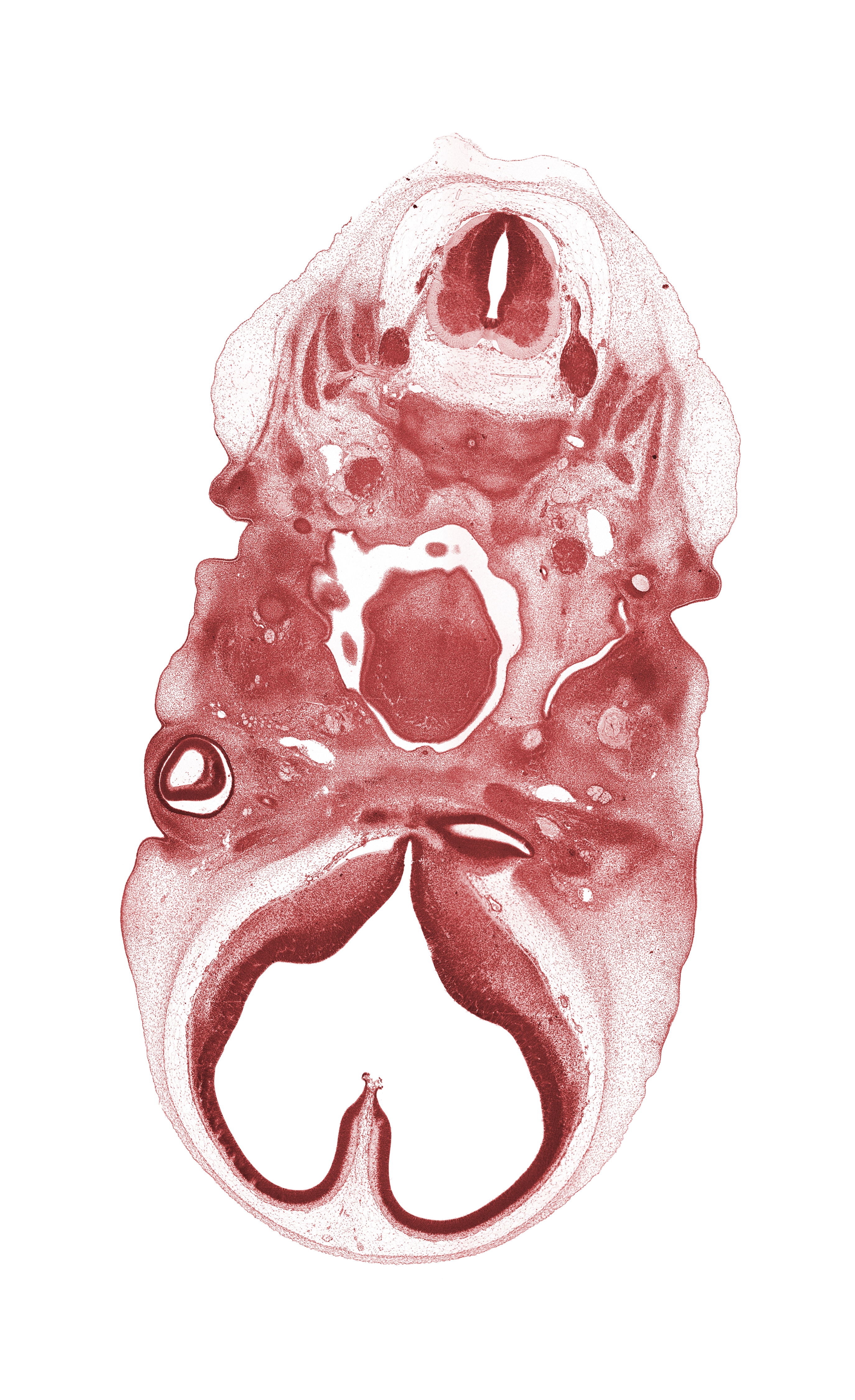 C-2 dorsal root, C-2 spinal ganglion, accessory nerve (CN XI), atlanto-occipital joint, basisphenoid condensation, blastemata of tongue muscles, dens of C-2 vertebra (axis) region, edge of epiglottis, inferior ganglion of glossopharyngeal nerve (CN IX), internal carotid artery, lamina terminalis, lower eyelid, mandibular nerve (CN V₃), maxillary nerve (CN V₂), maxillary vein, notochord, ophthalmic nerve (CN V₁), optic ventricle, pre-optic area, precardinal vein, root of tongue, stem of adenohypophysis, telencephalon, upper eyelid, vagus nerve (CN X)