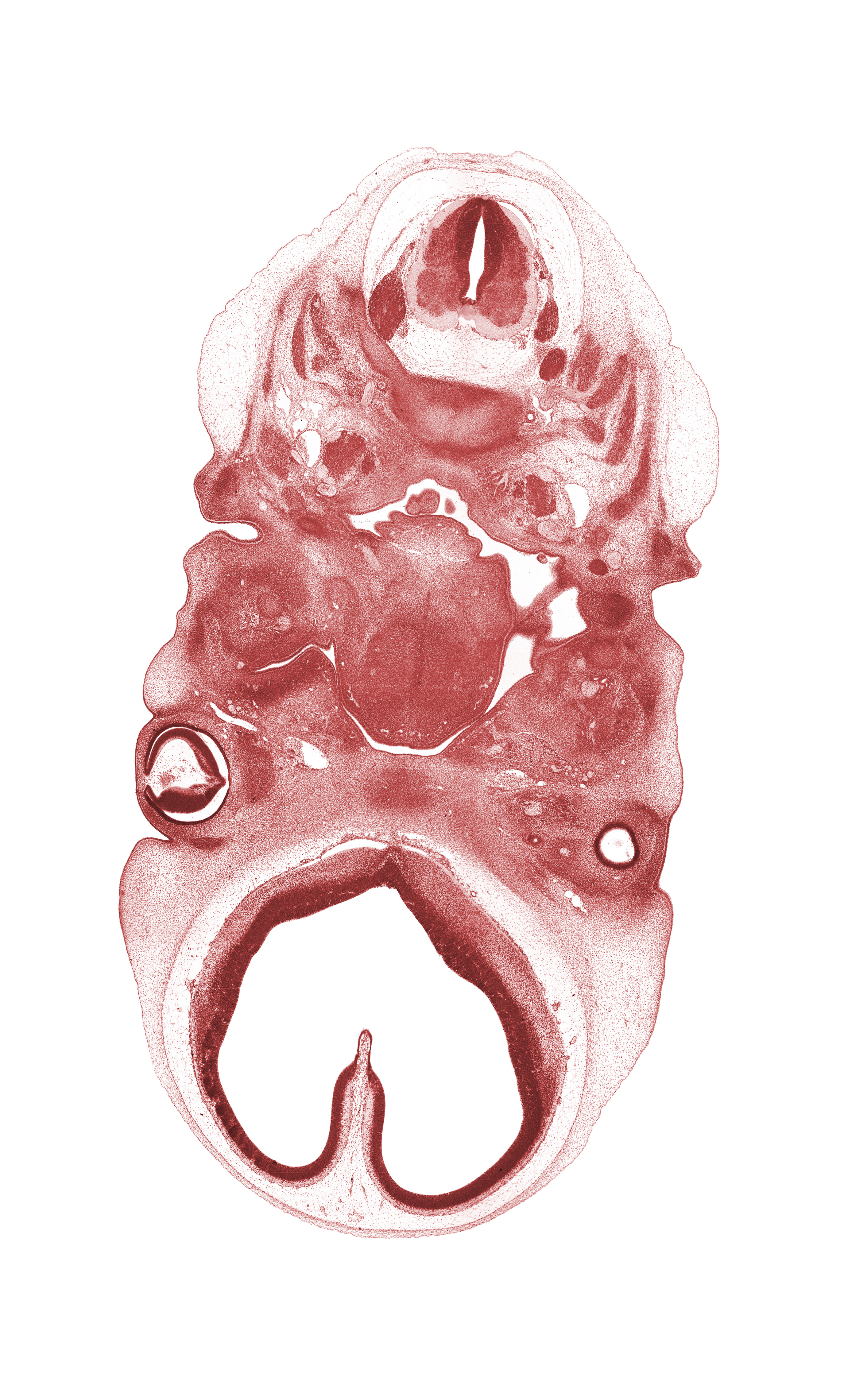 C-1 / C-2 intervertebral region, C-2 dorsal root, C-2 spinal ganglion, C-2 spinal nerve, C-3 spinal ganglion, basisphenoid condensation, centrum of C-2 vertebra (axis), edge of intraretinal space (optic vesicle cavity), external acoustic meatus, glossopharyngeal nerve (CN IX), hypoglossal nerve (CN XII), inferior ganglion of vagus nerve (CN X), maxillary venous plexus, neural arch of C-2 vertebra (axis), optic stalk (CN II), palatine shelf, precardinal vein, root of tongue, spinal accessory nerve (CN XI), telencephalon medium, vertebral artery