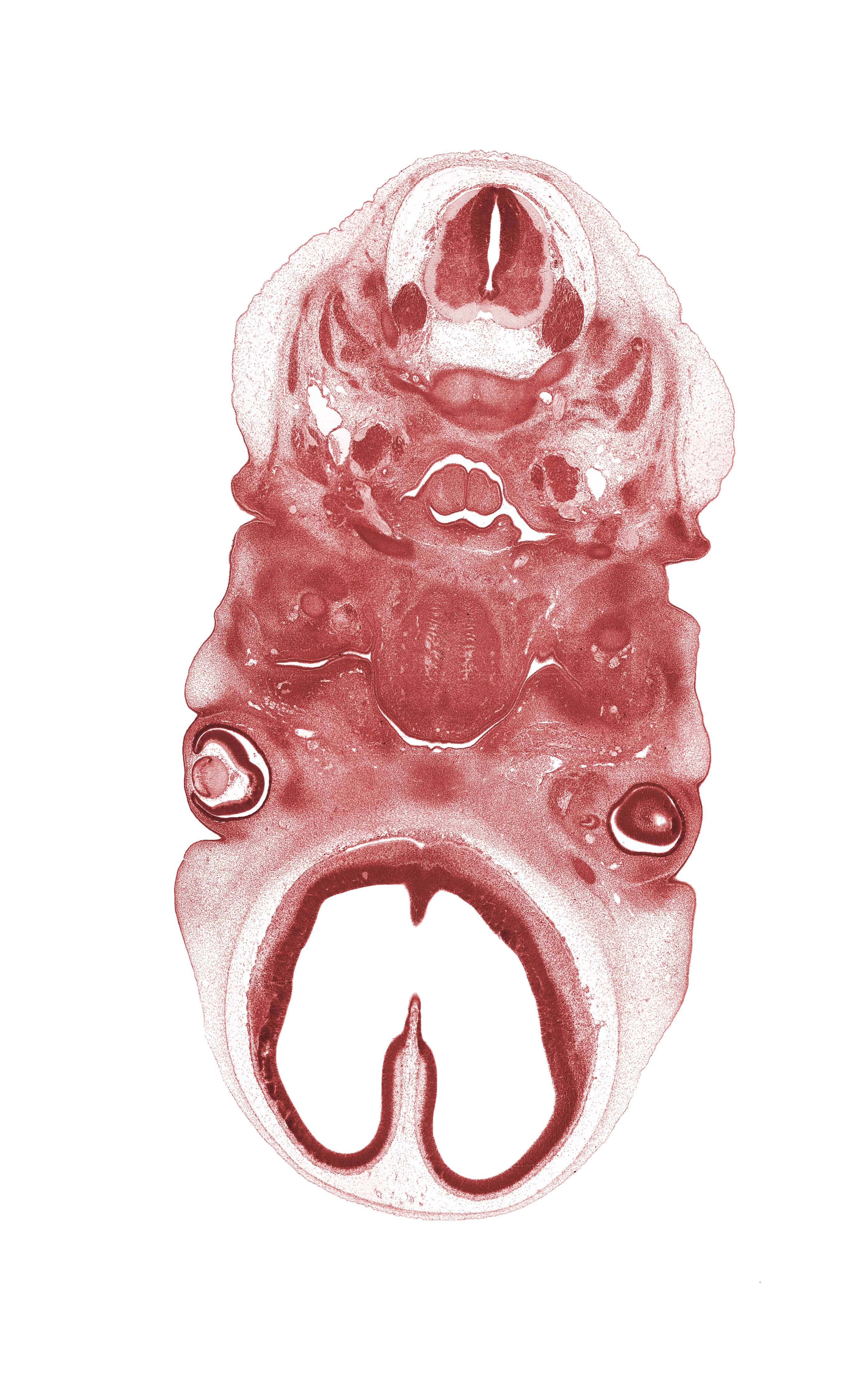 C-2 spinal nerve, C-3 dorsal root, C-3 spinal ganglion, auricle, blastemata of mastication muscles, centrum of C-2 vertebra (axis), cervical plexus, cornea, epiglottis, glossopharyngeal nerve (CN IX), interventricular foramen, laryngeal pharynx, larynx, lateral ventricle, lens, optic stalk (CN II), precartilage condensation of pharyngeal arch 2, spinal accessory nerve (CN XI)