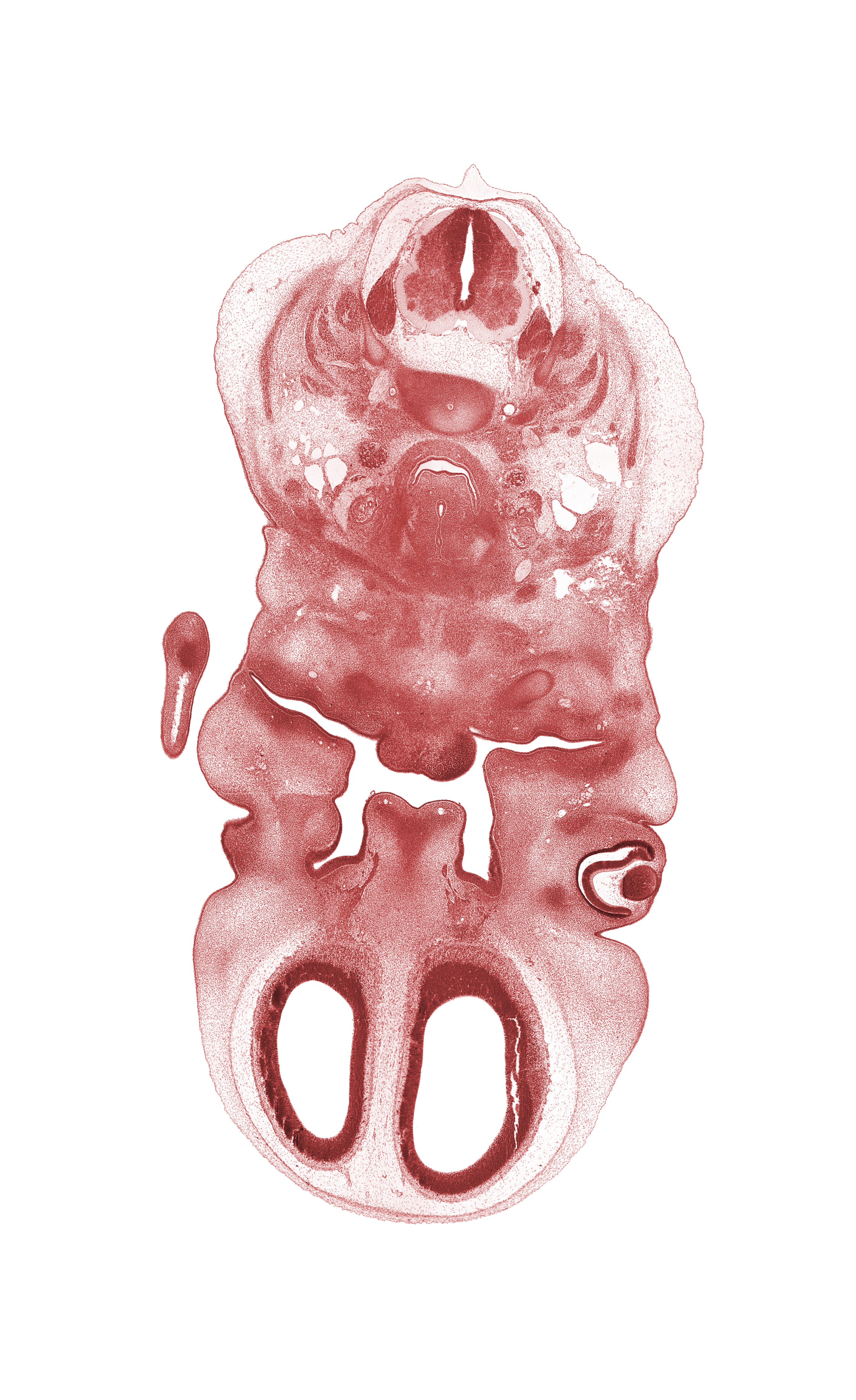 C-3 / C-4 intervertebral disc, C-4 spinal ganglion, C-4 spinal nerve, artifact fracture(s), cervical plexus, choana, edge of body of tongue, hand ray condensation, hypoglossal nerve (CN XII), larynx condensation, mandibular nerve (CN V₃), marginal vein, nasal disc (olfactory placode), nasal septum, olfactory bulb, olfactory filia (CN I), oral cavity, palatine shelf, precardinal vein, semispinalis capitis muscle, semispinalis cervicis muscle, splenius muscle, subarachnoid space, trapezius muscle, vomeronasal nerve