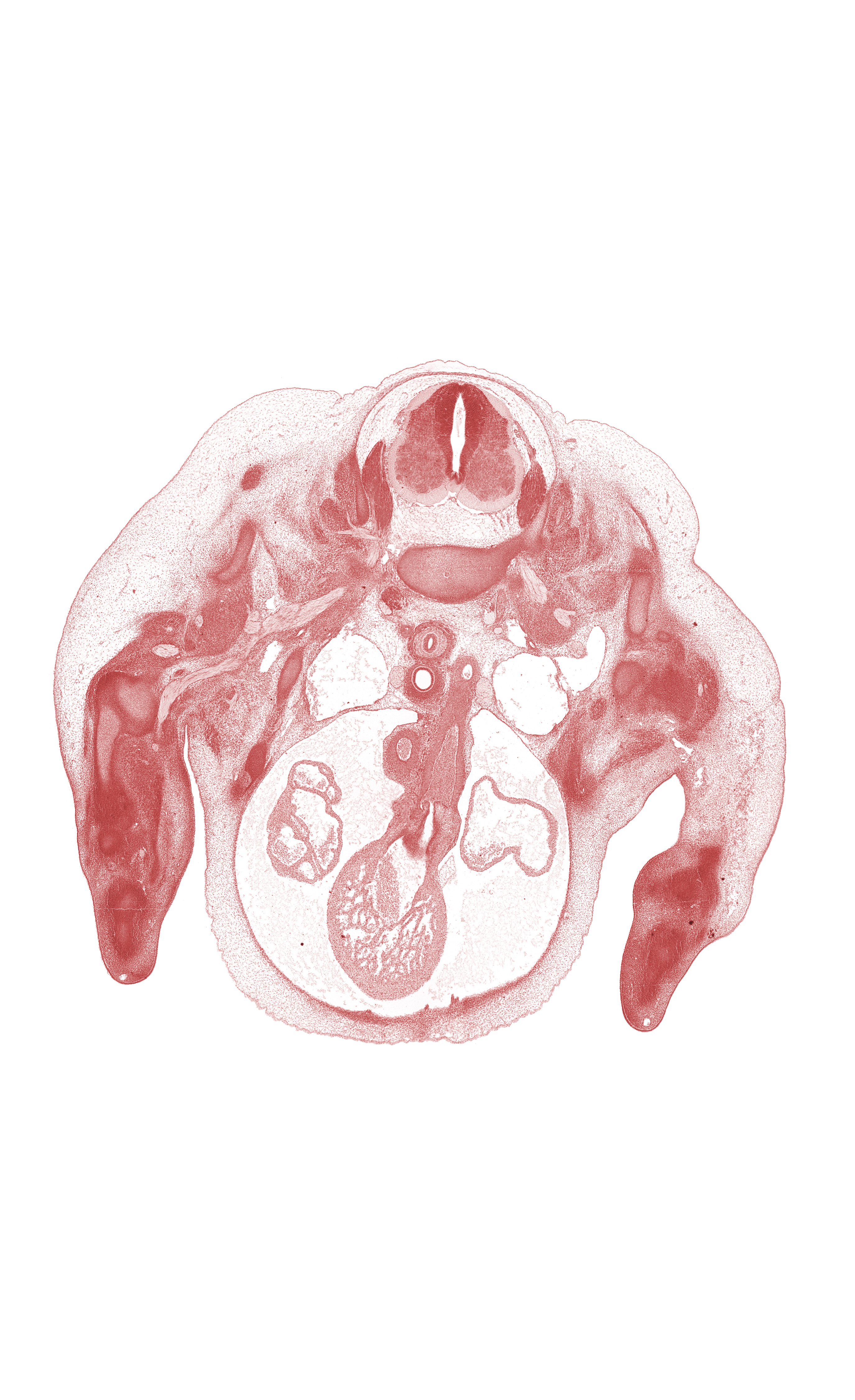 C-7 spinal ganglion, C-7 ventral primary ramus, aorta, ascending aorta, axillary artery, brachial plexus, carpus, central canal, dorsal fasciculus, hand ray, inferior cervical sympathetic ganglion, infundibulum of right ventricle, left atrium, left vagus nerve (CN X), pectoralis major muscle, precardinal vein, pulmonary semilunar valve, pulmonary trunk, retro-esophageal space, right atrium, right vagus nerve (CN X), subclavian artery, trabecular part of right ventricle, ventral horn of grey matter