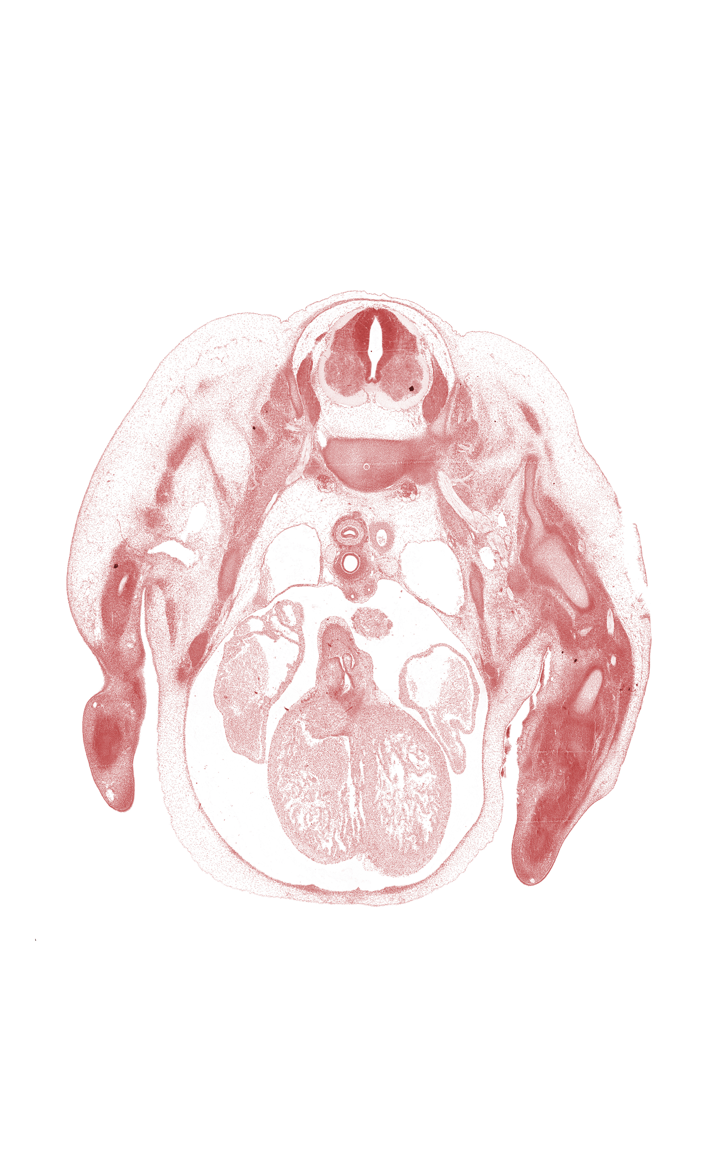 C-7 / T-1 intervertebral disc, C-8 spinal ganglion, C-8 spinal nerve, aorticopulmonary septum region, blastemata of extensor muscles in forearm, edge of left atrium, edge of pleural cavity, glenohumeral joint, interventricular sulcus, left atrium, left ventricle, lower trunk of brachial plexus (C-8, T-1), middle trunk of brachial plexus (C-7), pericardial cavity, rib 1, right atrium, right precardinal vein, right pulmonary artery, right ventricle, sympathetic trunk, upper trunk of brachial plexus (C-5, C-6)