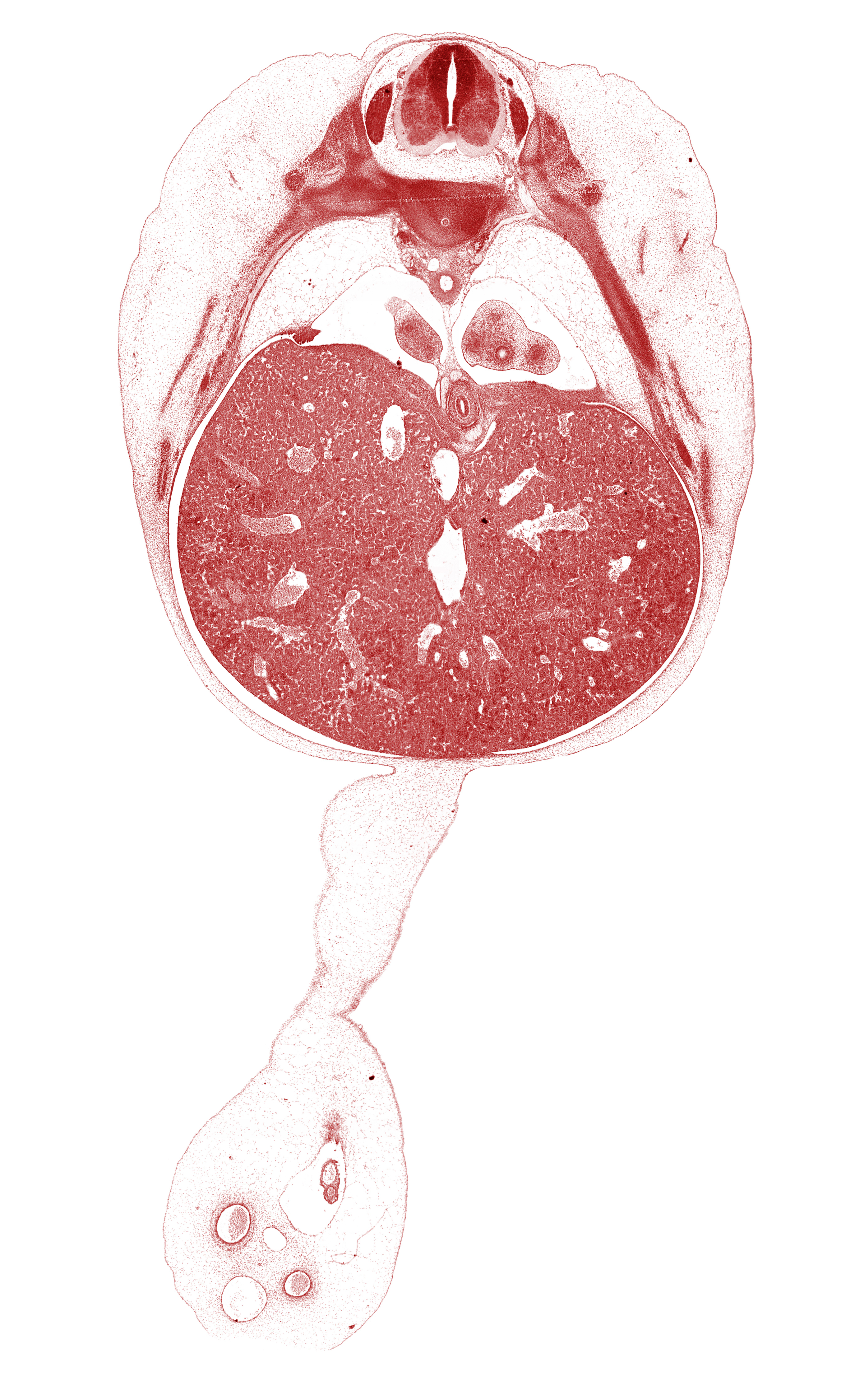 T-8 / T-9 intervertebral disc, T-8 intercostal nerve, T-8 spinal ganglion, allantois, dorsal meso-esophagus, ductus venosus, esophageal hiatus in diaphragm, left lobe of liver, left umbilical artery, lower lobe of left lung, lower lobe of right lung, muscular part of diaphragm, omphalomesenteric artery, pleuroperitoneal opening, rib 10, rib 9, right lobe of liver, right umbilical artery, umbilical coelom, umbilical cord, umbilical vein