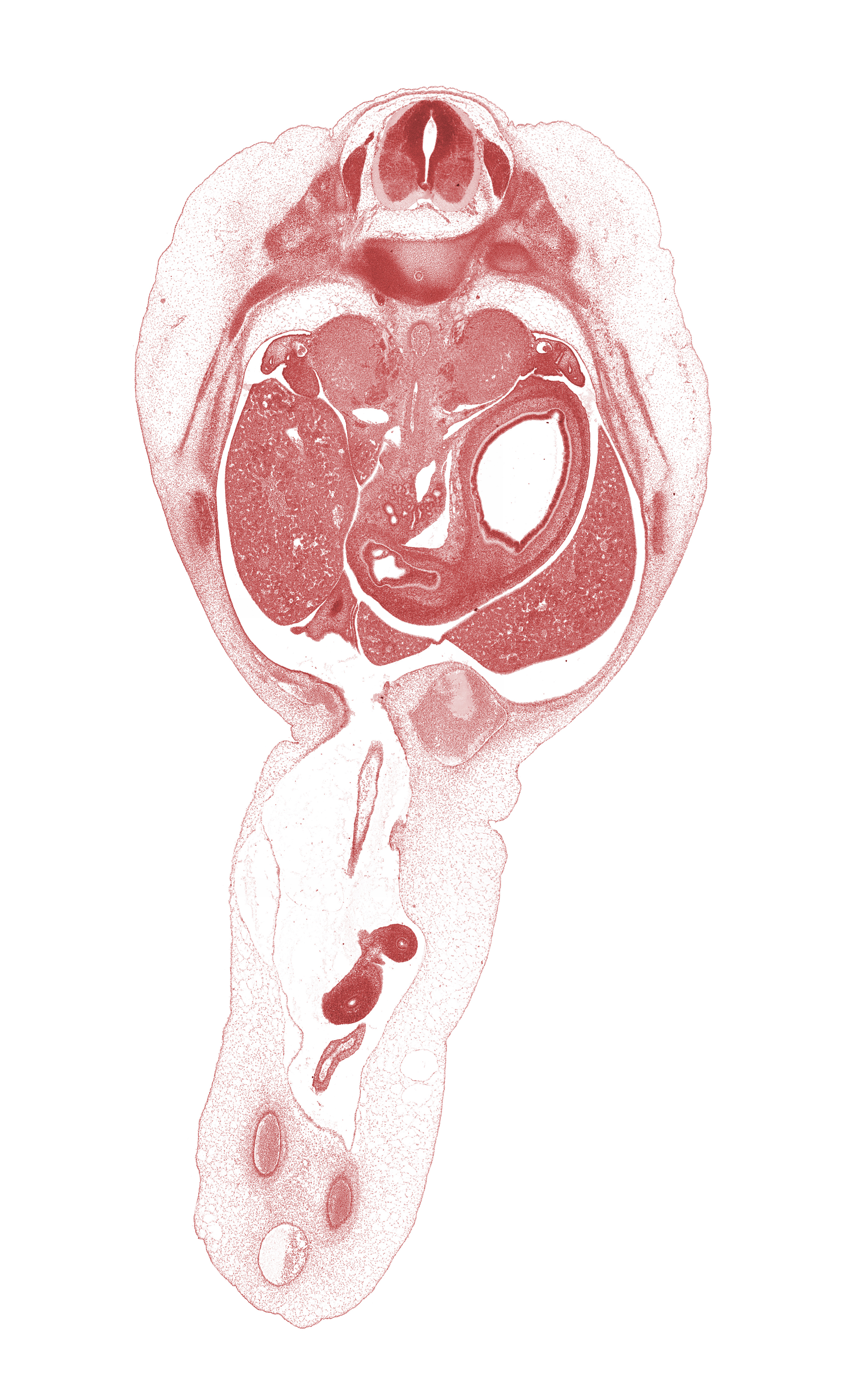 T-10 spinal ganglion, aorta, bile duct, cephalic edge of gonadal ridge, cystic duct, distal limb of herniated midgut, greater curvature of stomach, greater splanchnic nerve, head of rib 11, hepatic portal vein, inferior vena cava, junction of peritoneal cavity and umbilical coelom, lesser curvature of stomach, omphalomesenteric artery, proper hepatic artery, superior mesenteric artery, umbilical coelom, umbilical vein