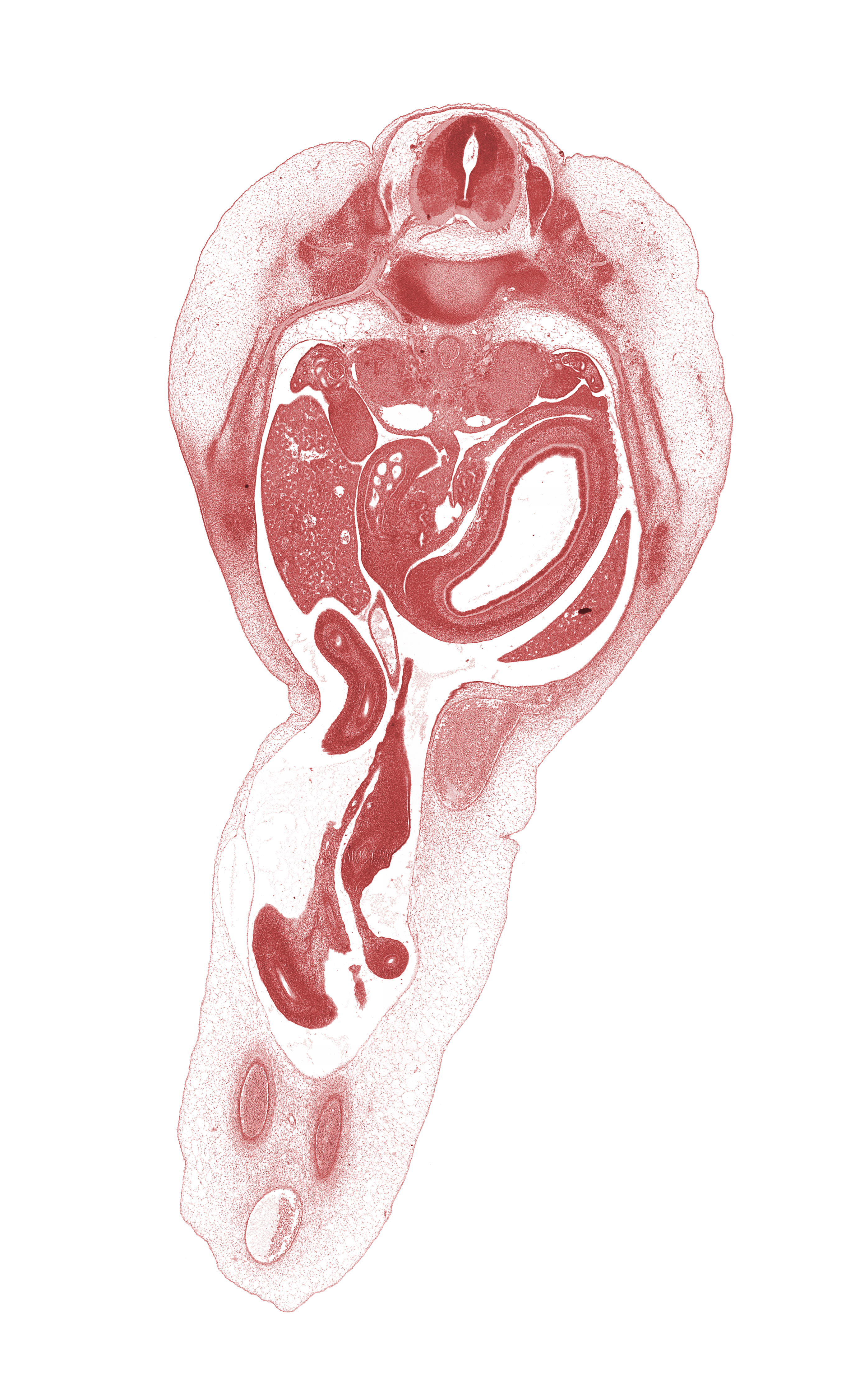 T-11 spinal ganglion, allantois, aorta, communicating ramus, gonadal ridge, inferior vena cava, left lobe of liver, lumen of body of stomach, lumen of pyloric antrum of stomach, midgut mesentery, proximal limb of herniated midgut, right lobe of liver, spleen, superior mesenteric artery, superior mesenteric vein, sympathetic trunk, umbilical coelom, ventral pancreas