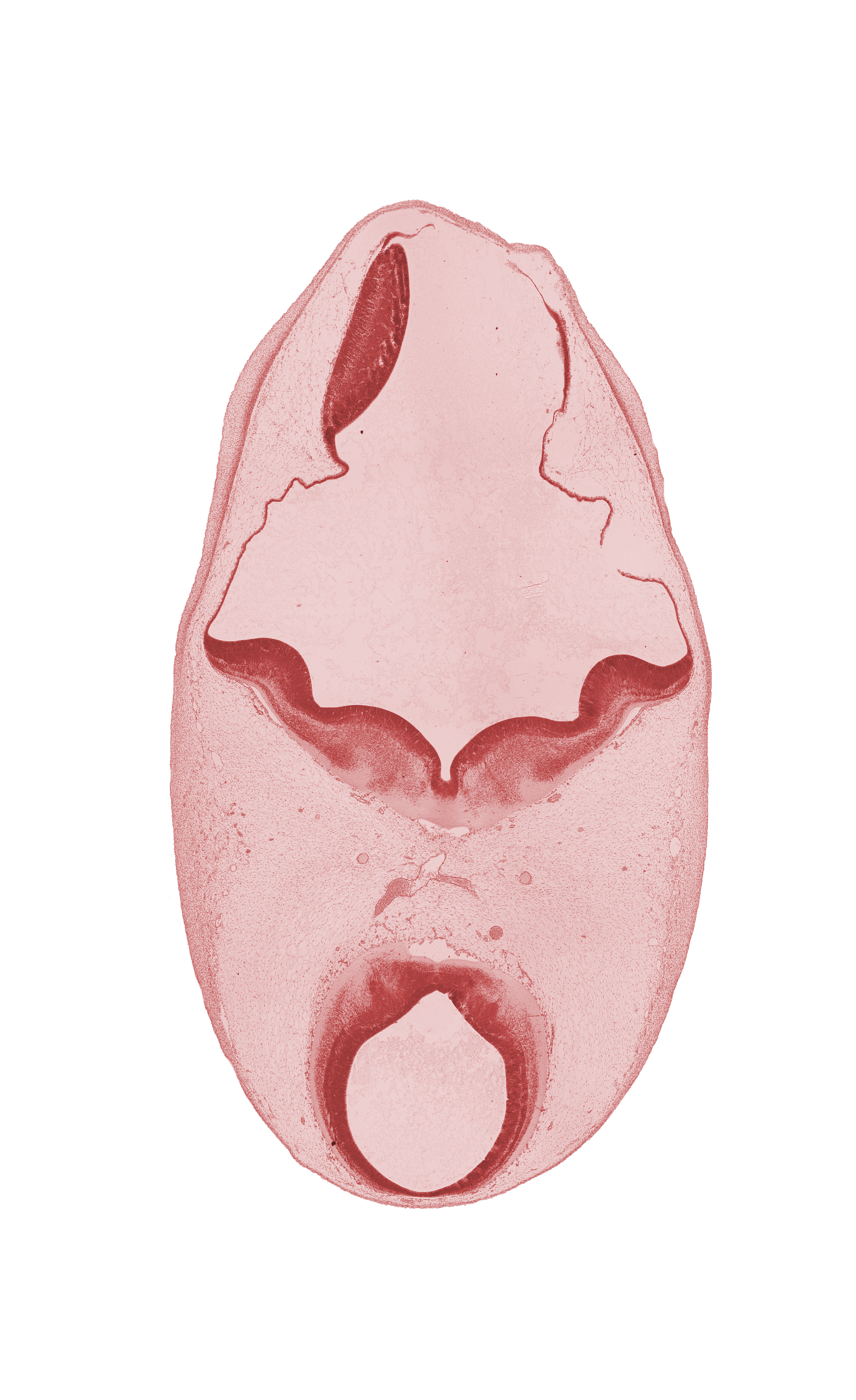 artifact separation(s), head mesenchyme, mesencephalon (M1), oculomotor nerve (CN III), osteogenic layer, posterior cerebral artery, subarachnoid space, surface ectoderm, termination of basilar artery, trochlear nerve (CN IV)