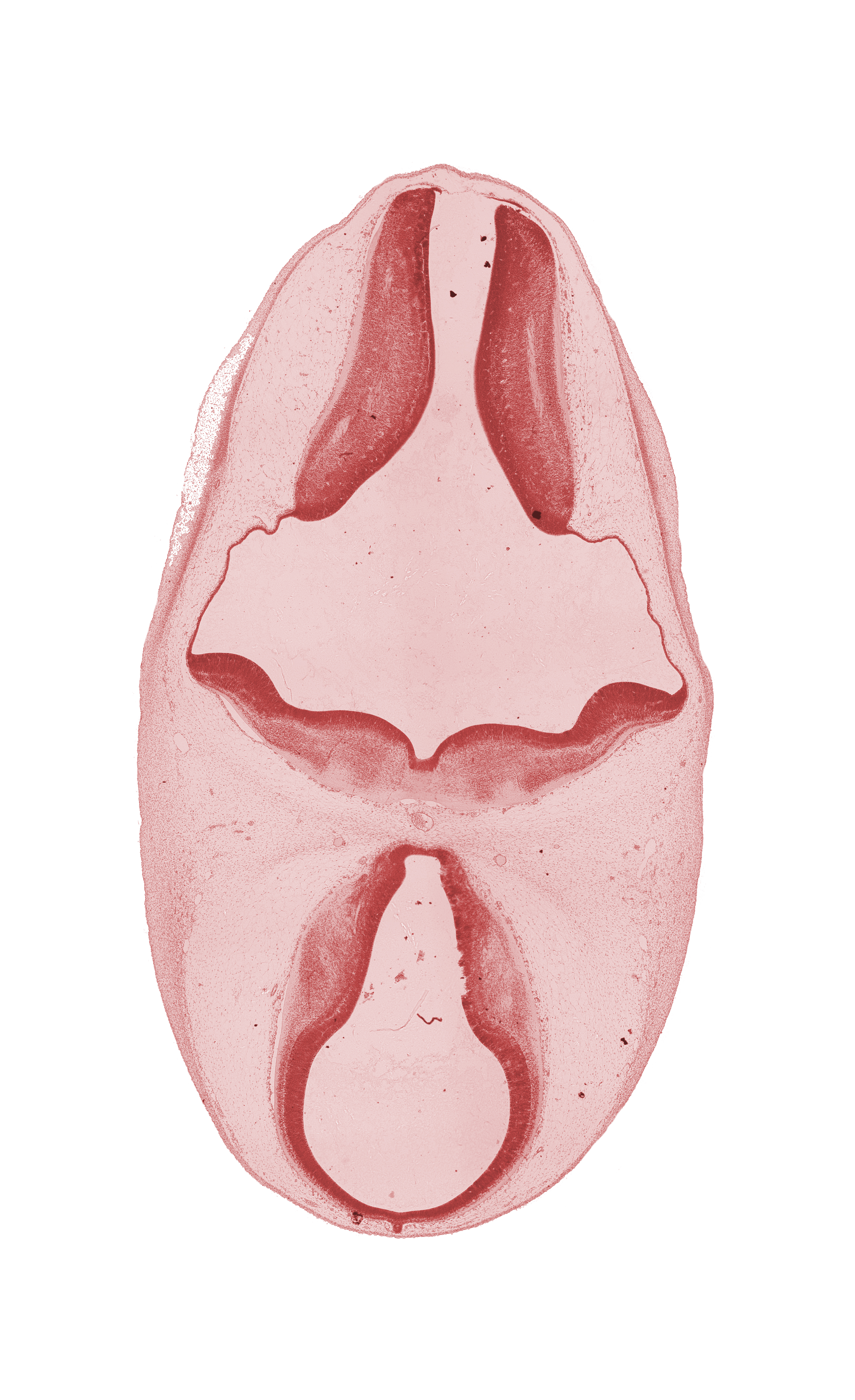 alar plate of myelencephalon, basilar artery, diencephalon, dorsal sulcus, dorsal thalamus, epithalamus, head mesenchyme, marginal ridge, median sulcus, oculomotor nerve (CN III), osteogenic layer, surface ectoderm, trochlear nerve (CN IV), ventral thalamus