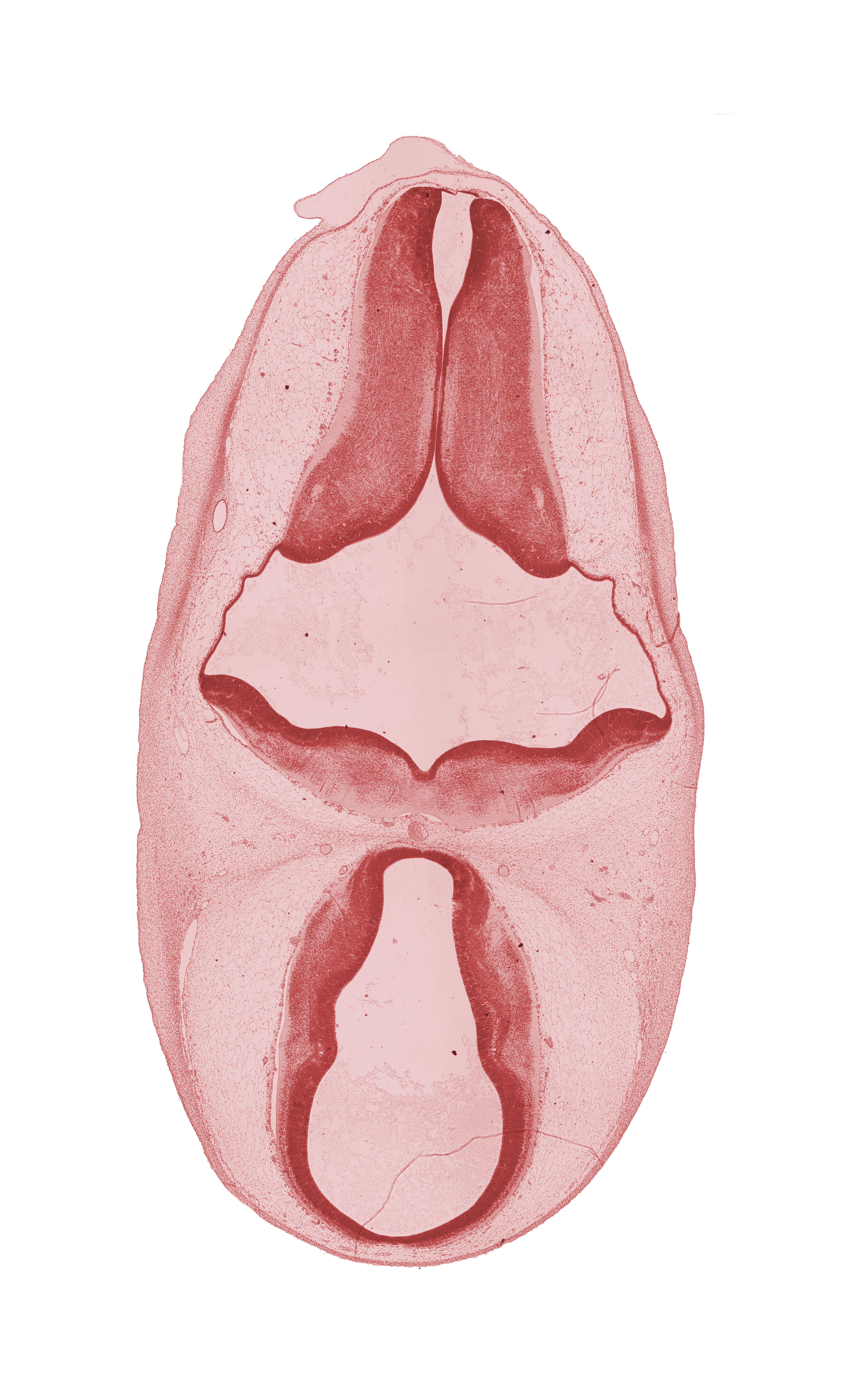 basilar artery, dorsal thalamus, edge of endolymphatic duct, hypothalamus, intermediate zone, marginal ridge, marginal zone, oculomotor nerve (CN III), osteogenic layer, trochlear nerve (CN IV), ventral thalamus, ventricular zone