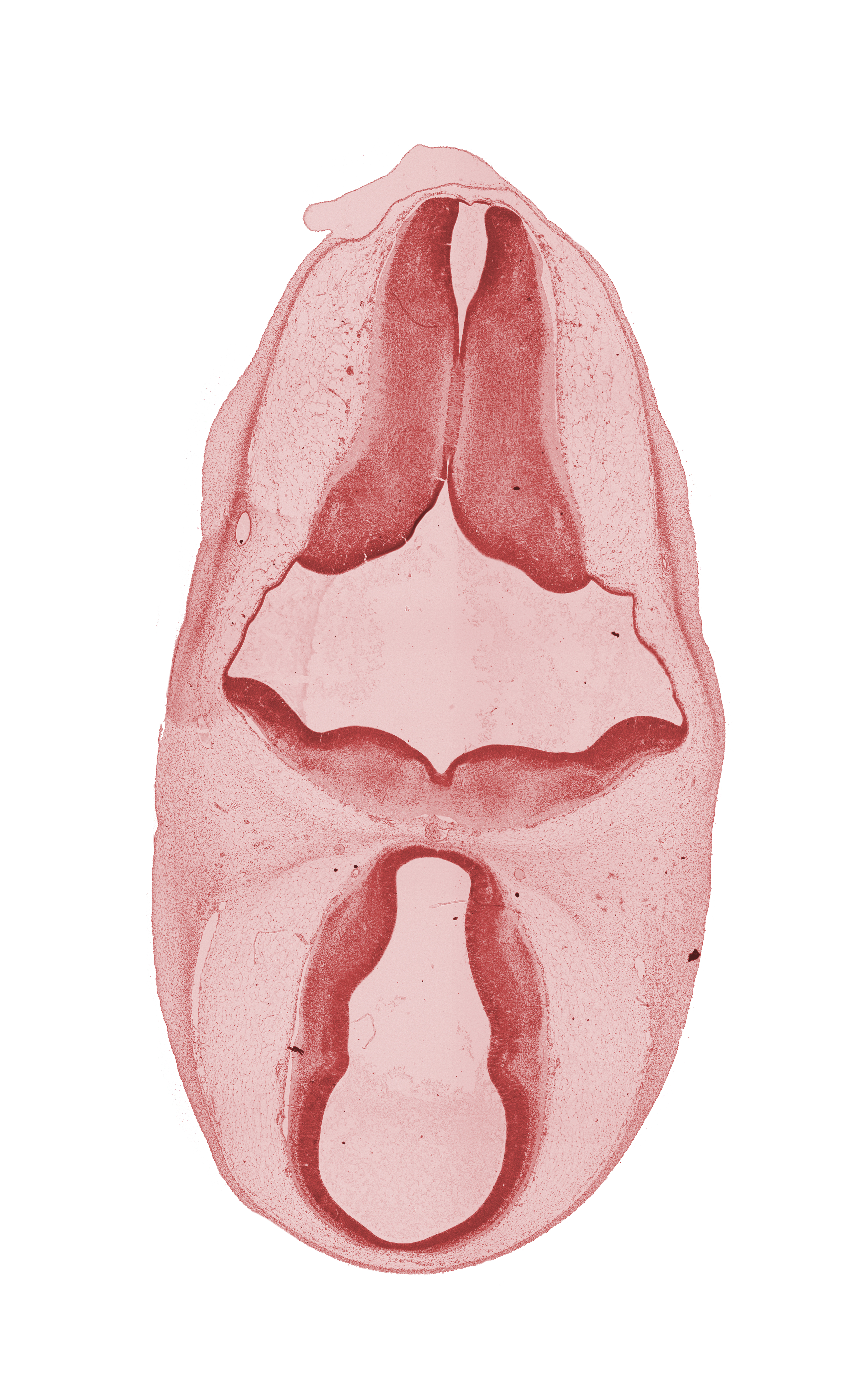 dorsal sulcus, dorsal thalamus, endolymphatic duct, epithalamus, hypothalamus, marginal ridge, osteogenic layer, rhombencoel (fourth ventricle), subarachnoid space, third ventricle, ventral thalamus